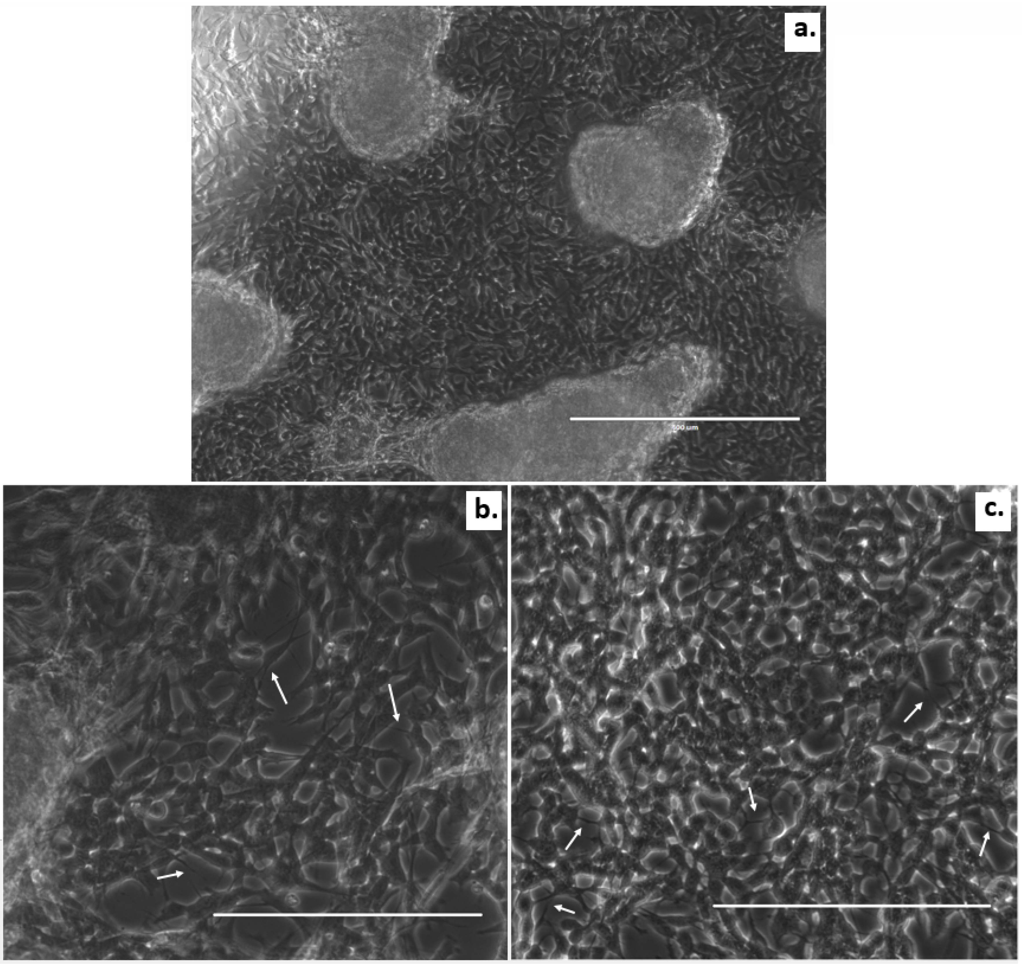 Micromachines 12 00165 g004