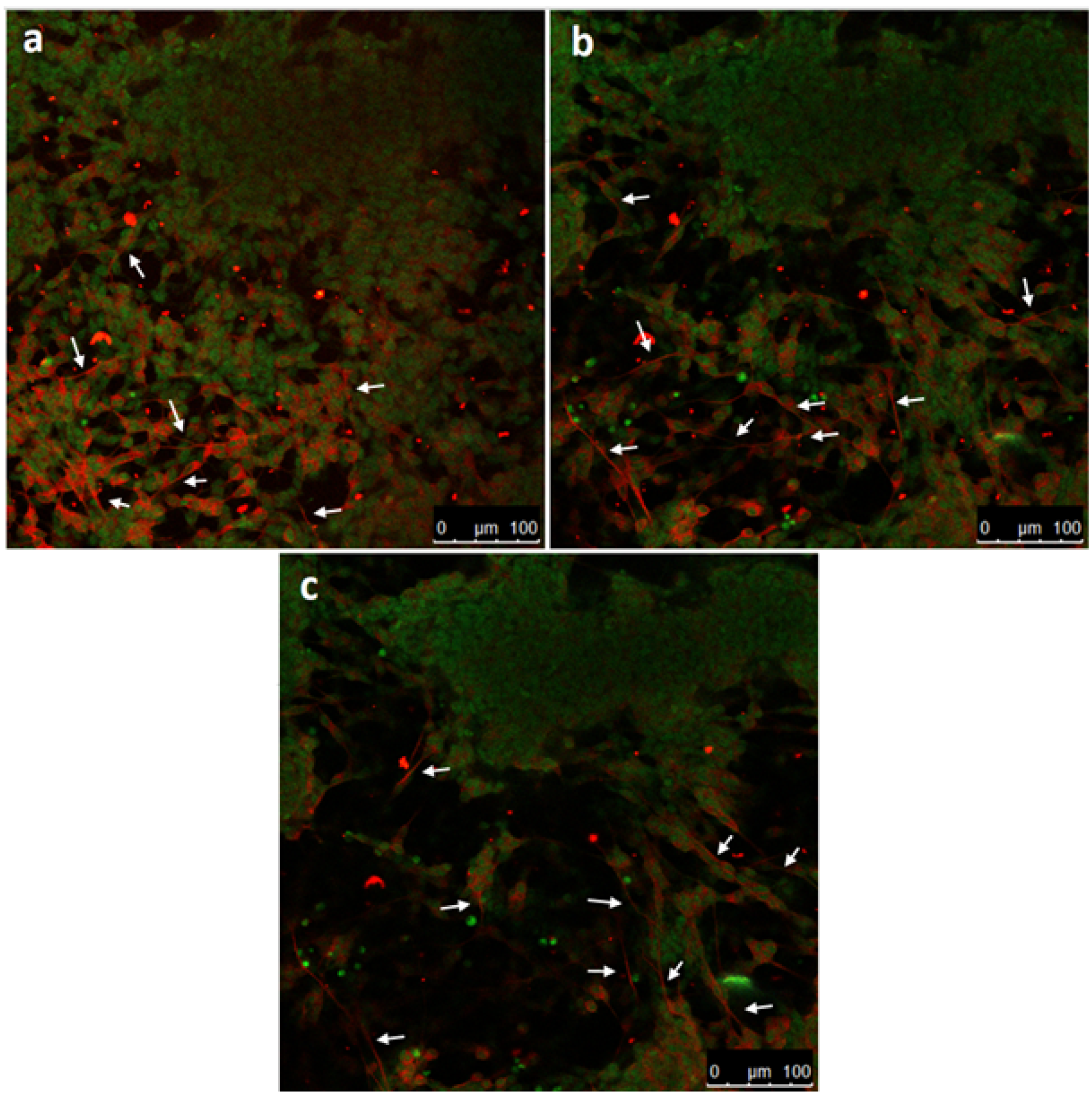Micromachines 12 00165 g005