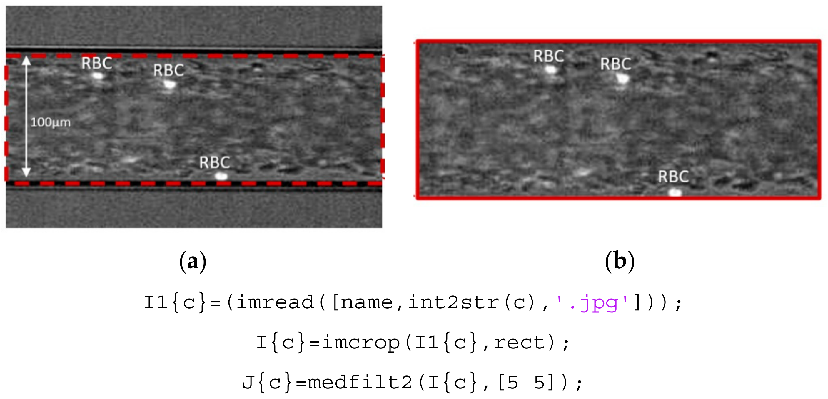 Micromachines 12 00317 g003