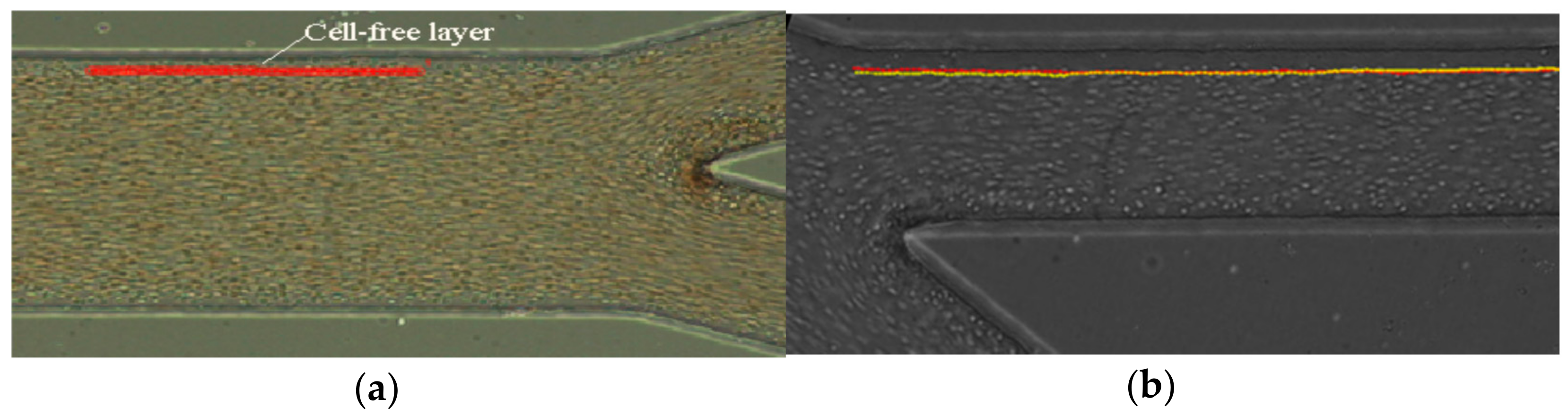 Micromachines 12 00317 g009