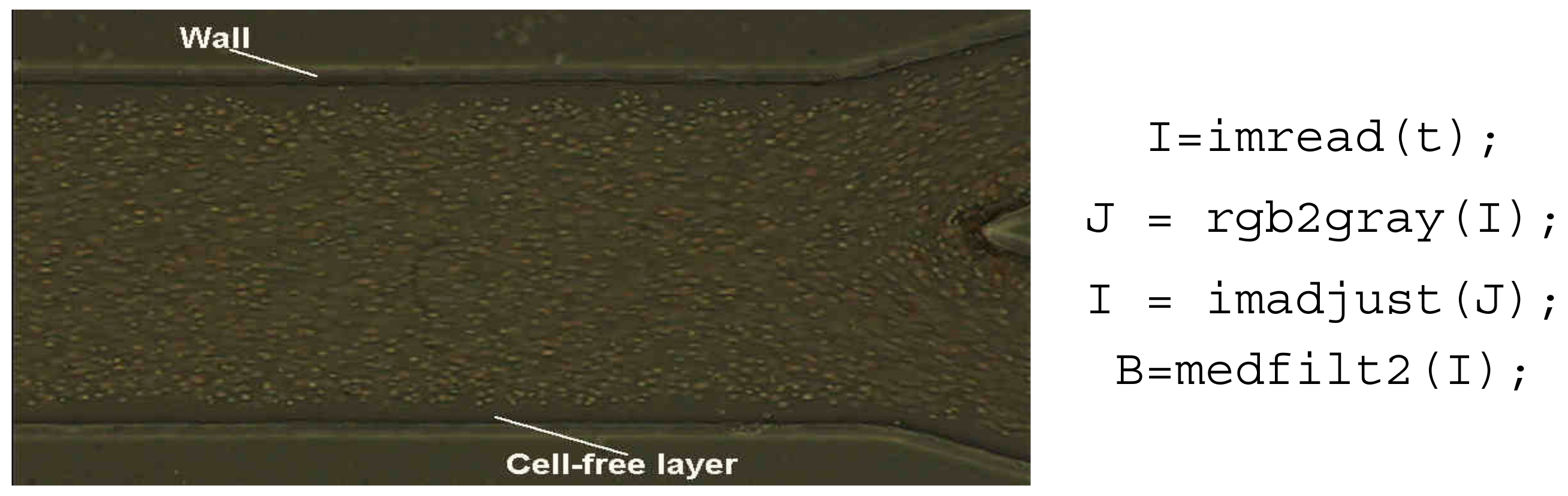 Micromachines 12 00317 g014