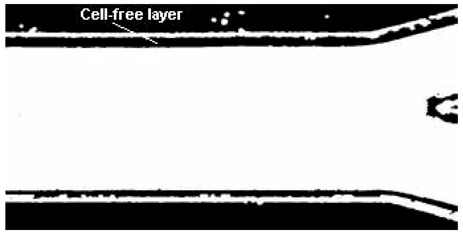 Micromachines 12 00317 g016