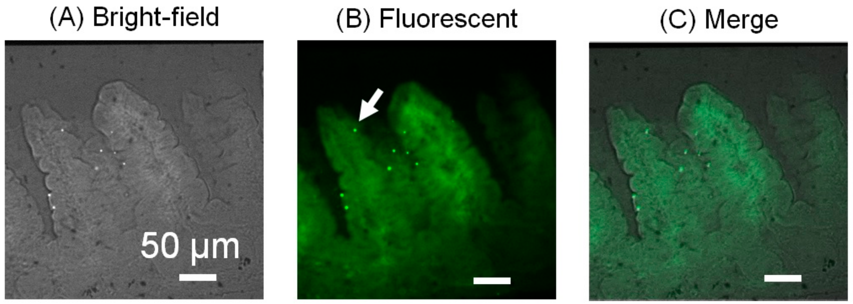 Micromachines 12 00692 g011