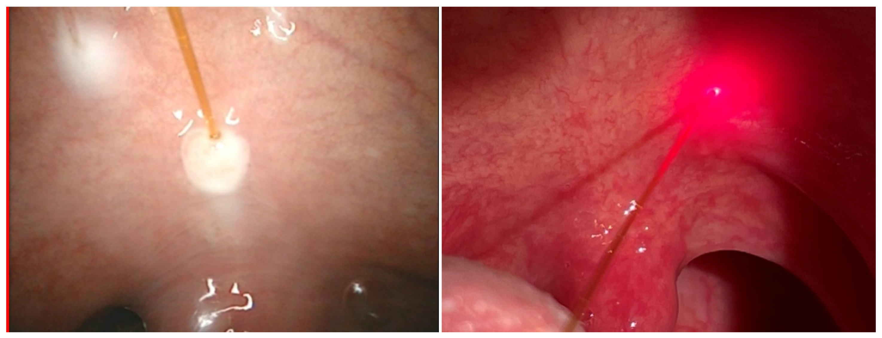 Micromachines 12 00710 g001 Micromachines 12 00710 g001