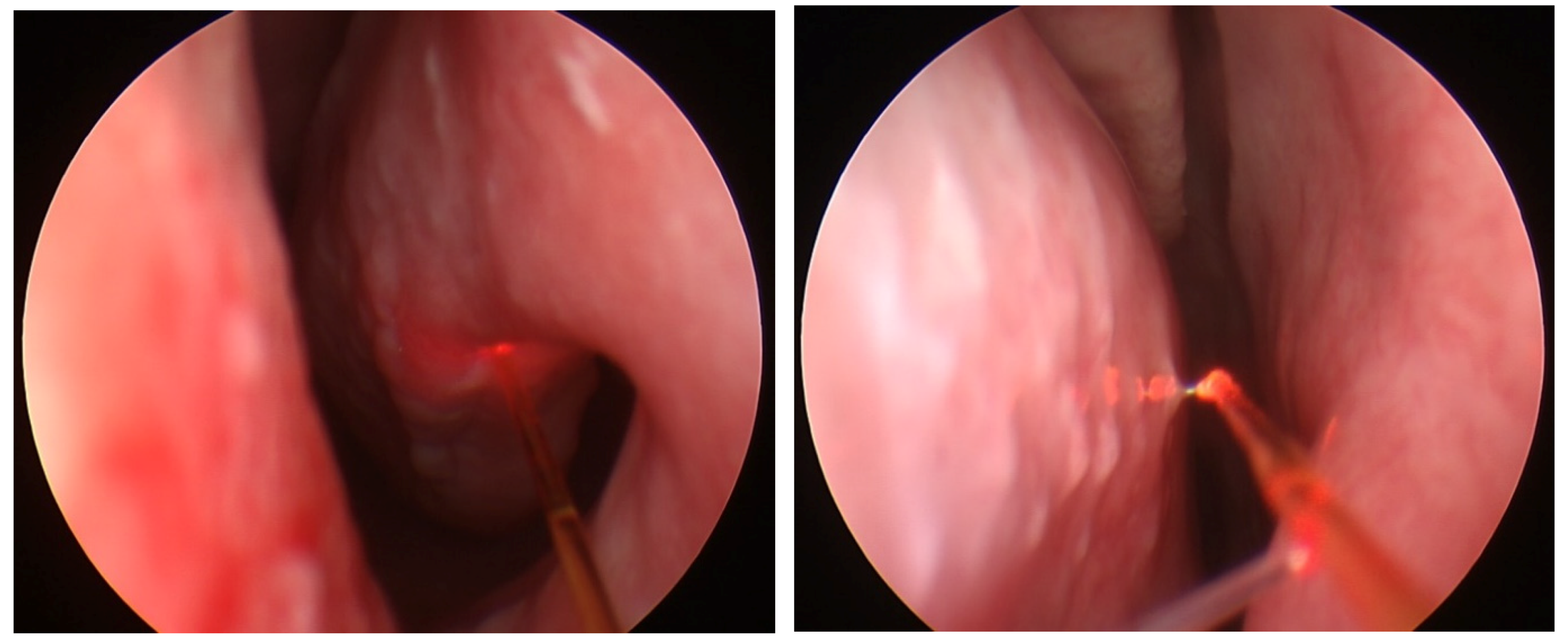 Micromachines 12 00710 g002 Micromachines 12 00710 g002