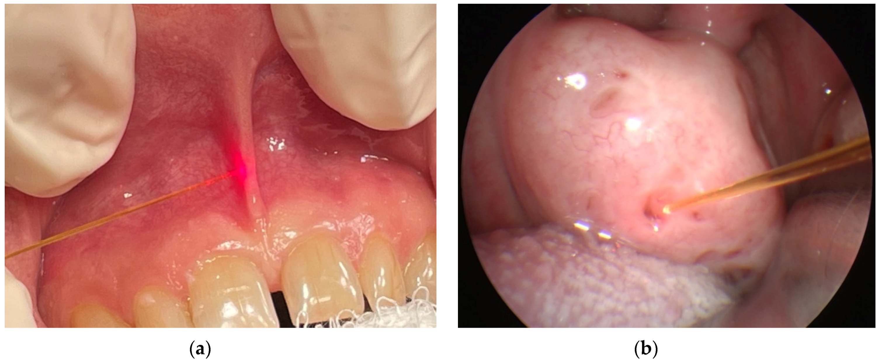 Micromachines 12 00710 g003 Micromachines 12 00710 g003