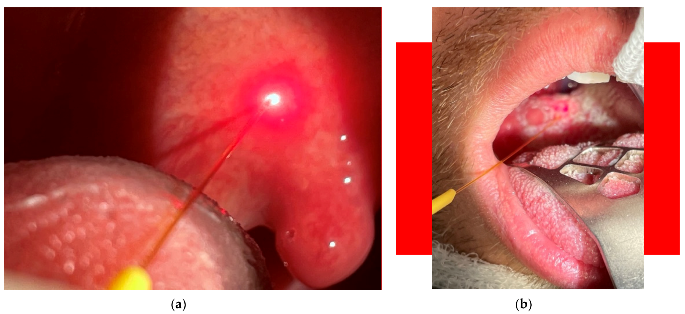 Micromachines 12 00710 g004 Micromachines 12 00710 g004