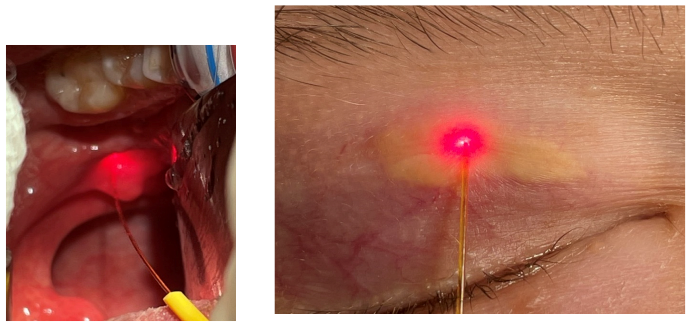 Micromachines 12 00710 g005 Micromachines 12 00710 g005