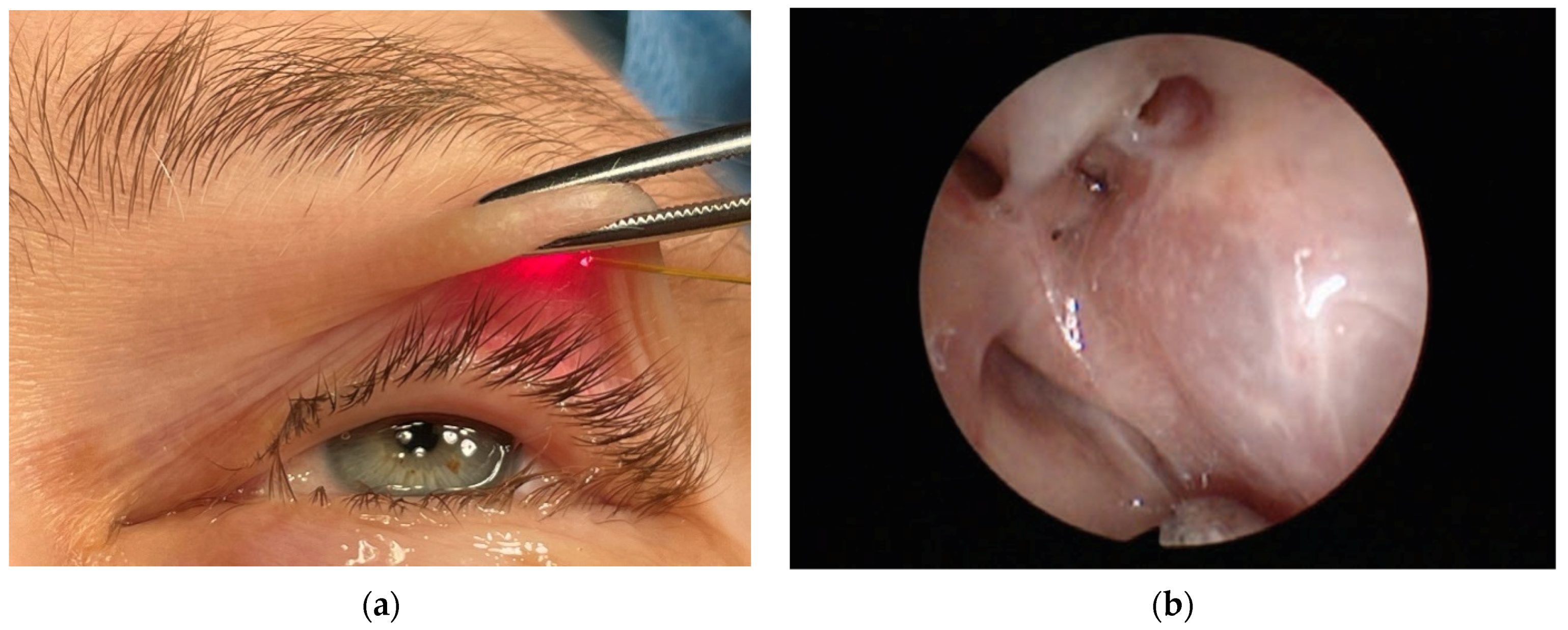 Micromachines 12 00710 g006 Micromachines 12 00710 g006