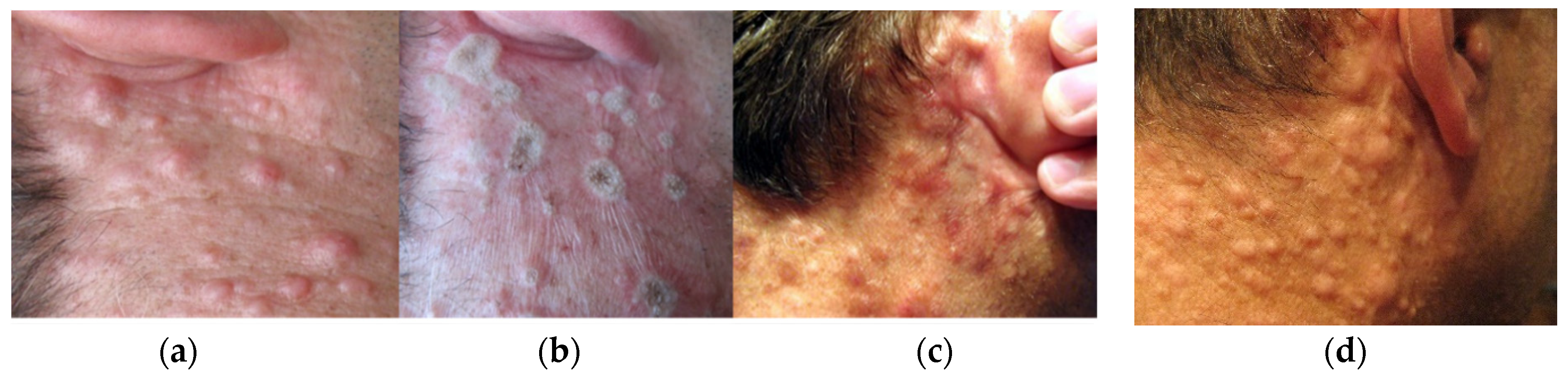 Micromachines 12 00710 g008 Micromachines 12 00710 g008