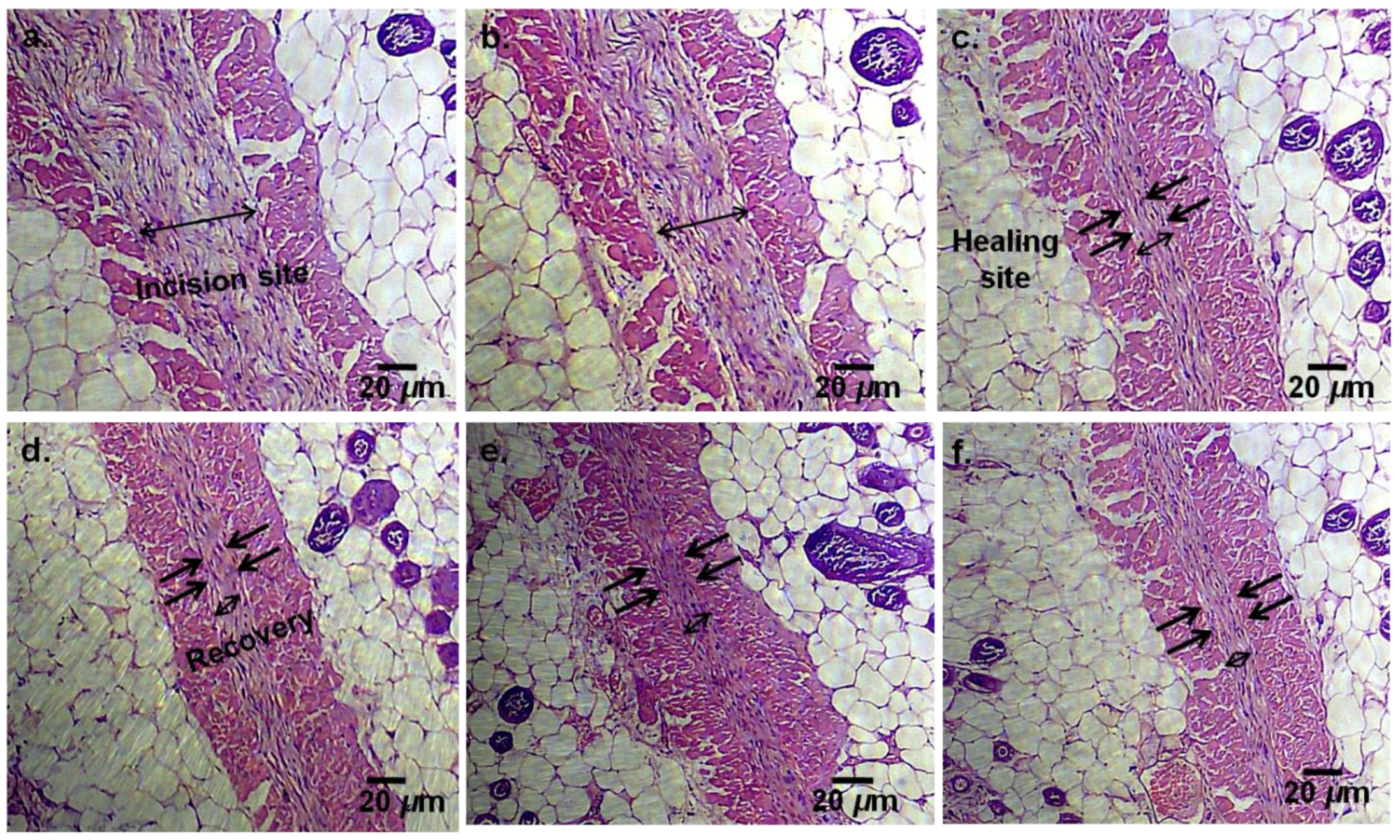 Micromachines 12 00975 g005