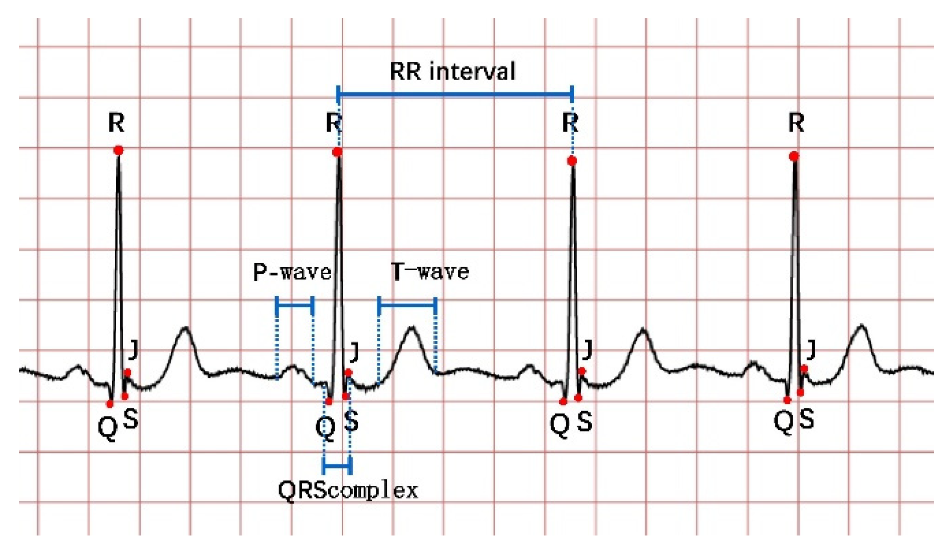 Micromachines 12 01282 g001