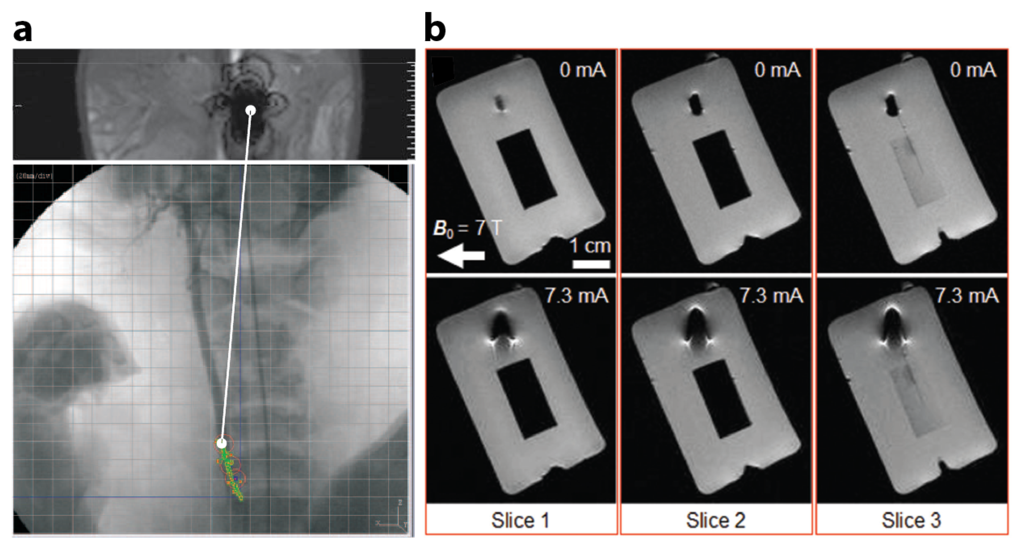 Micromachines 12 01310 g003