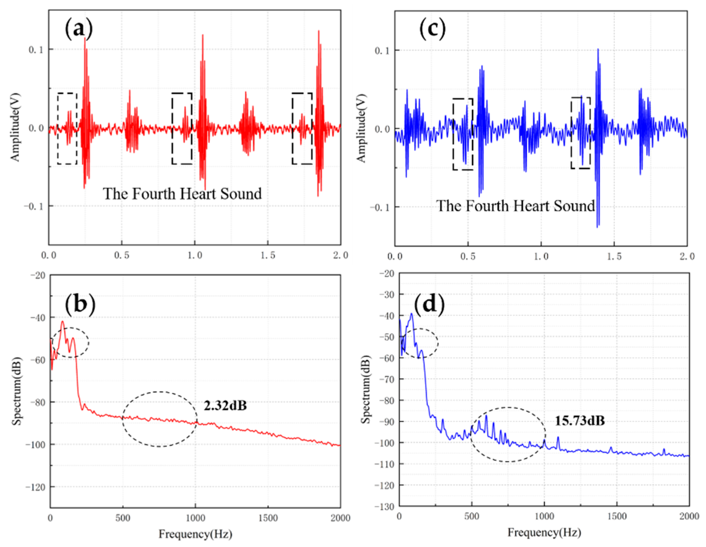 Micromachines 13 00163 g011