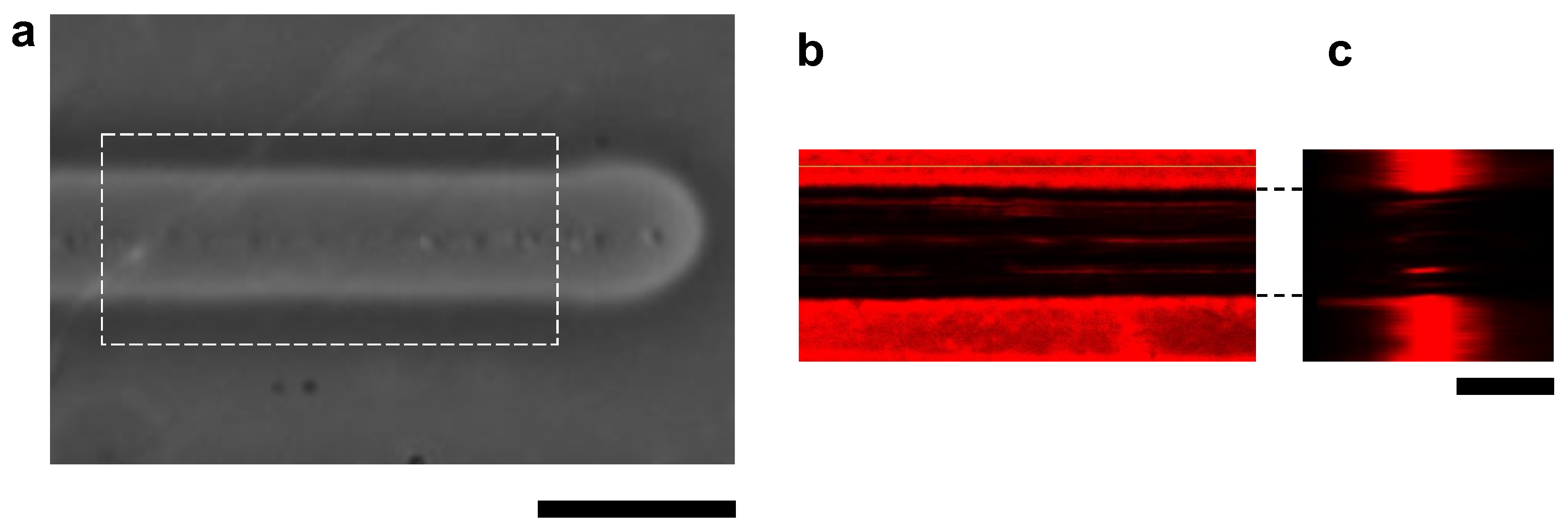 Micromachines 13 00174 g004