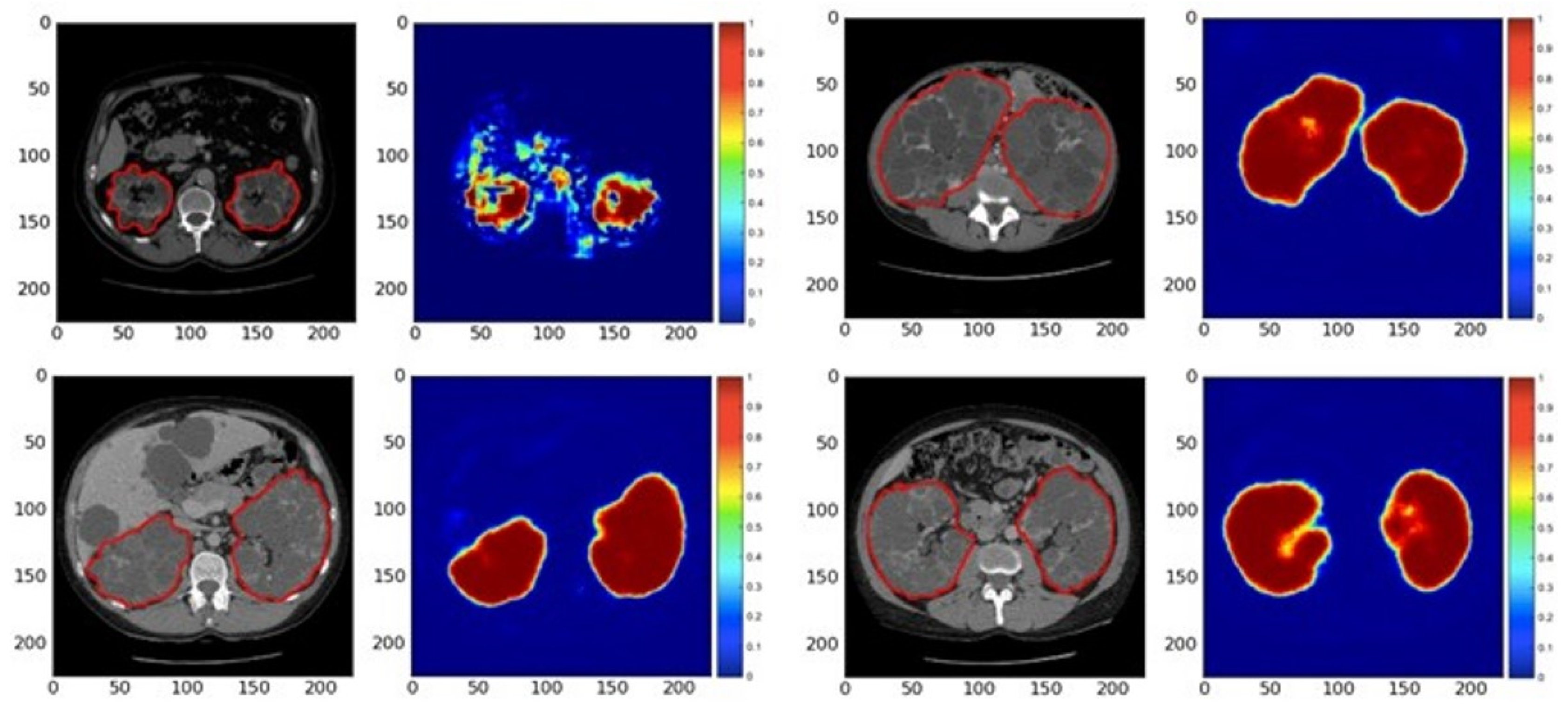 Micromachines 13 00260 g010