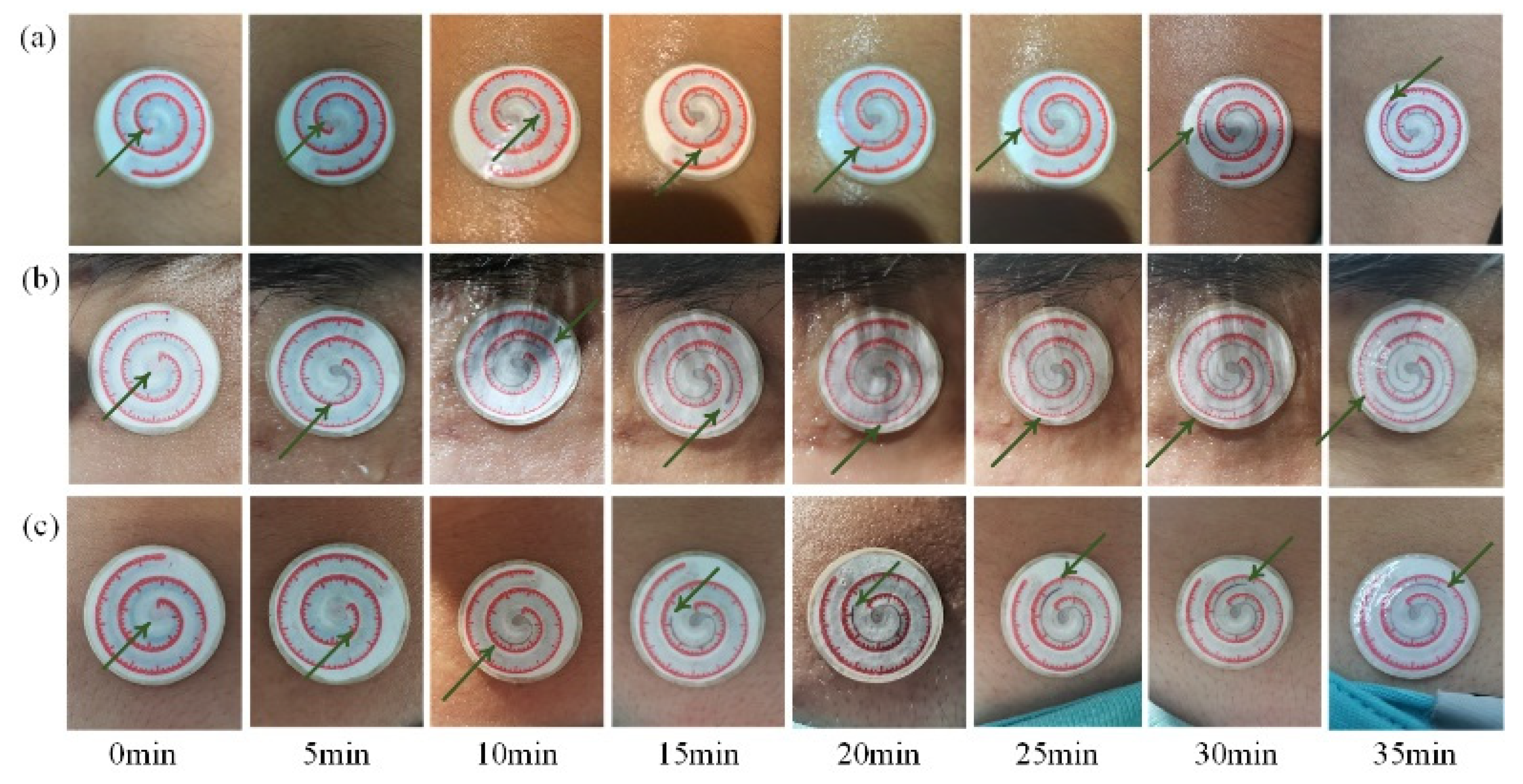 Micromachines 13 00414 g011