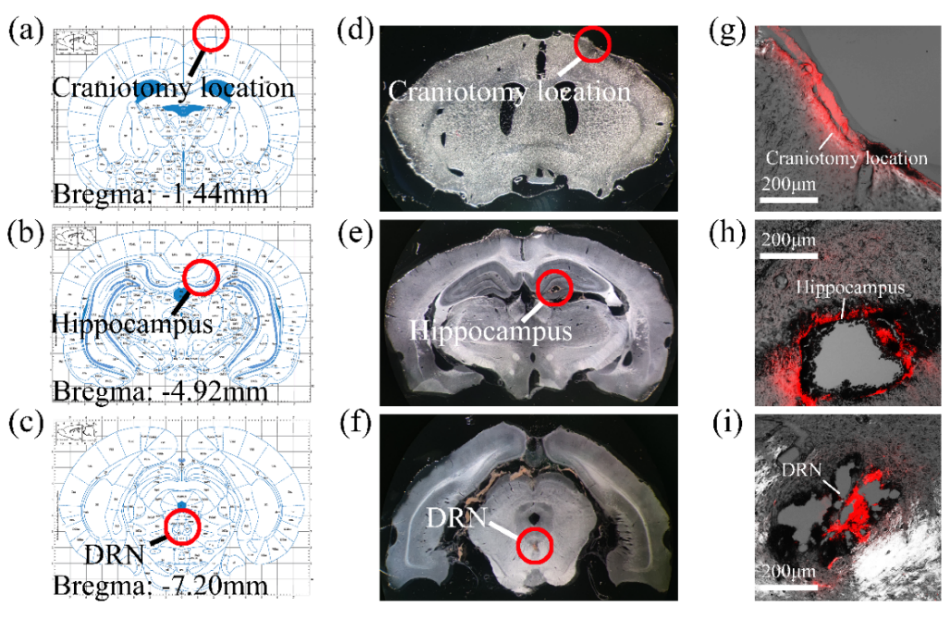 Micromachines 13 00488 g005