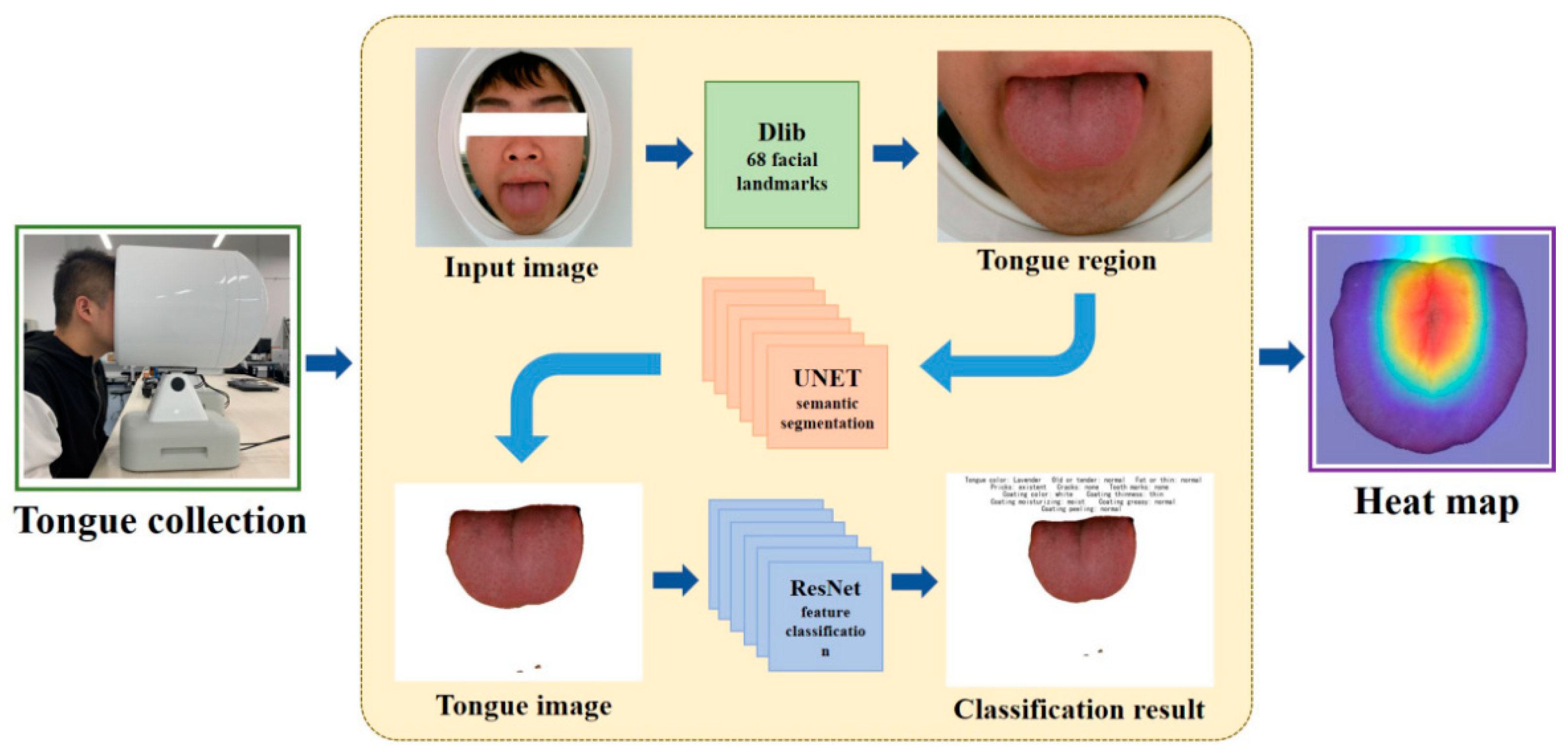 Micromachines 13 00501 g001