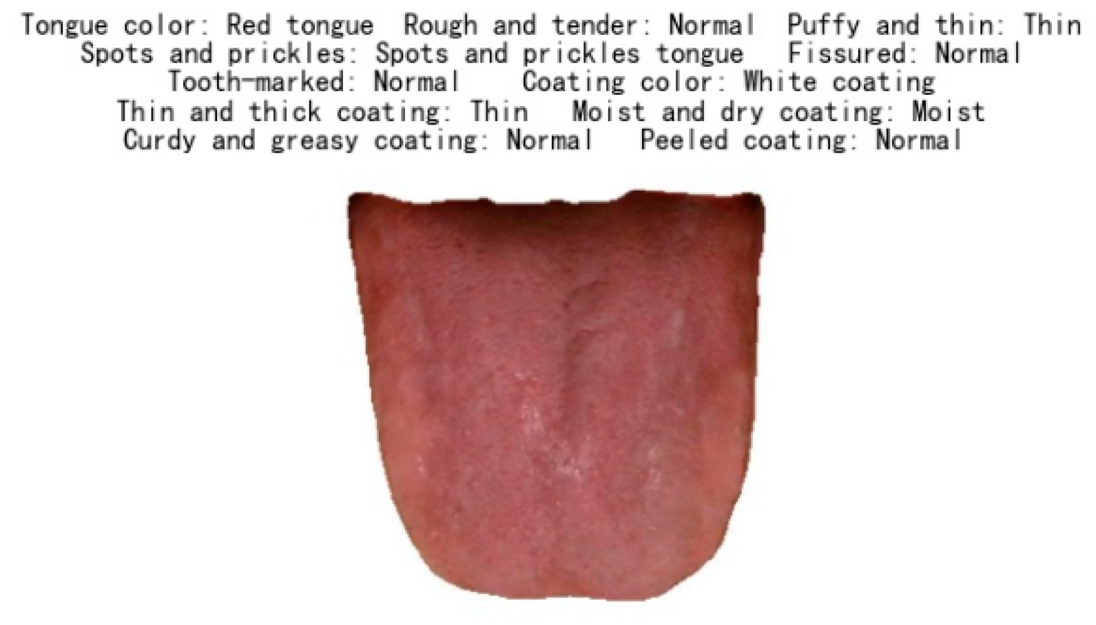 Micromachines 13 00501 g007