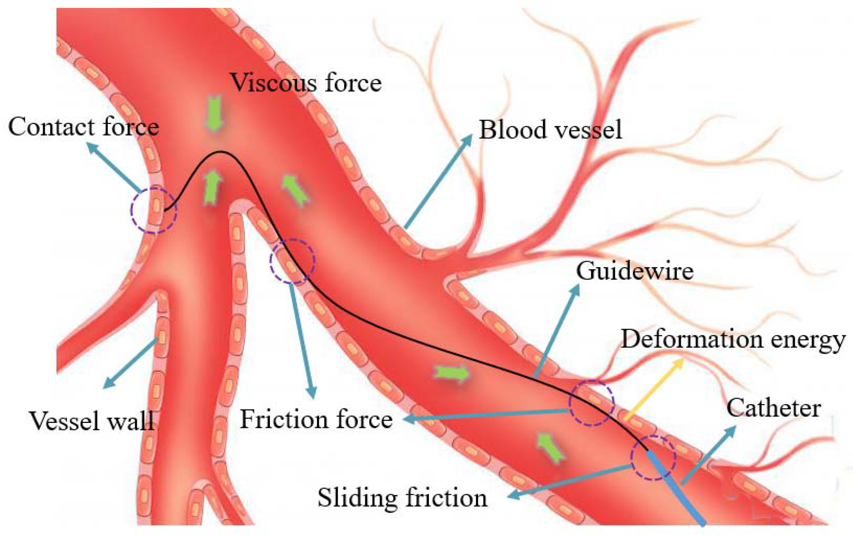 Micromachines 13 00505 g010