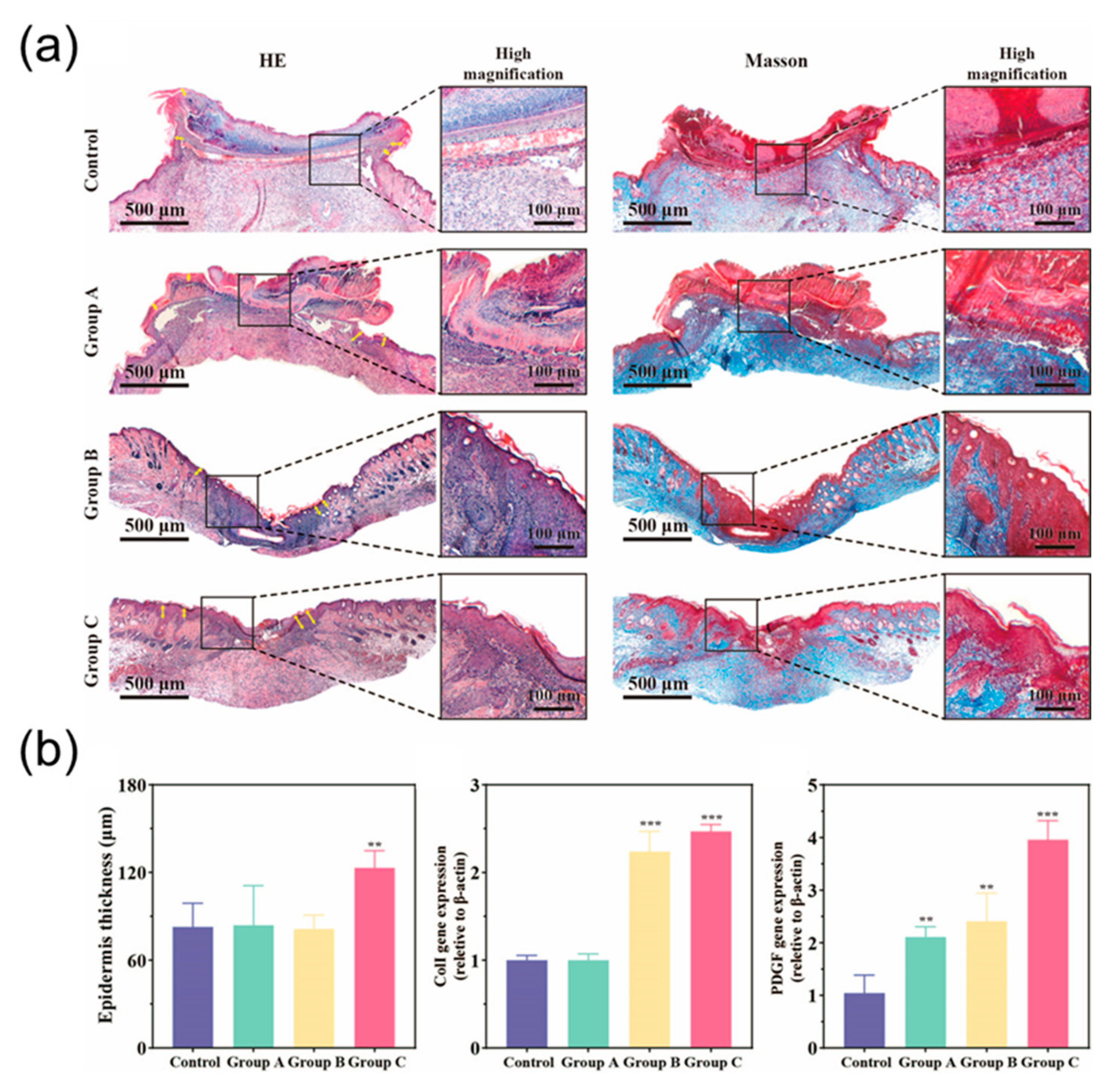 Micromachines 13 00561 g006