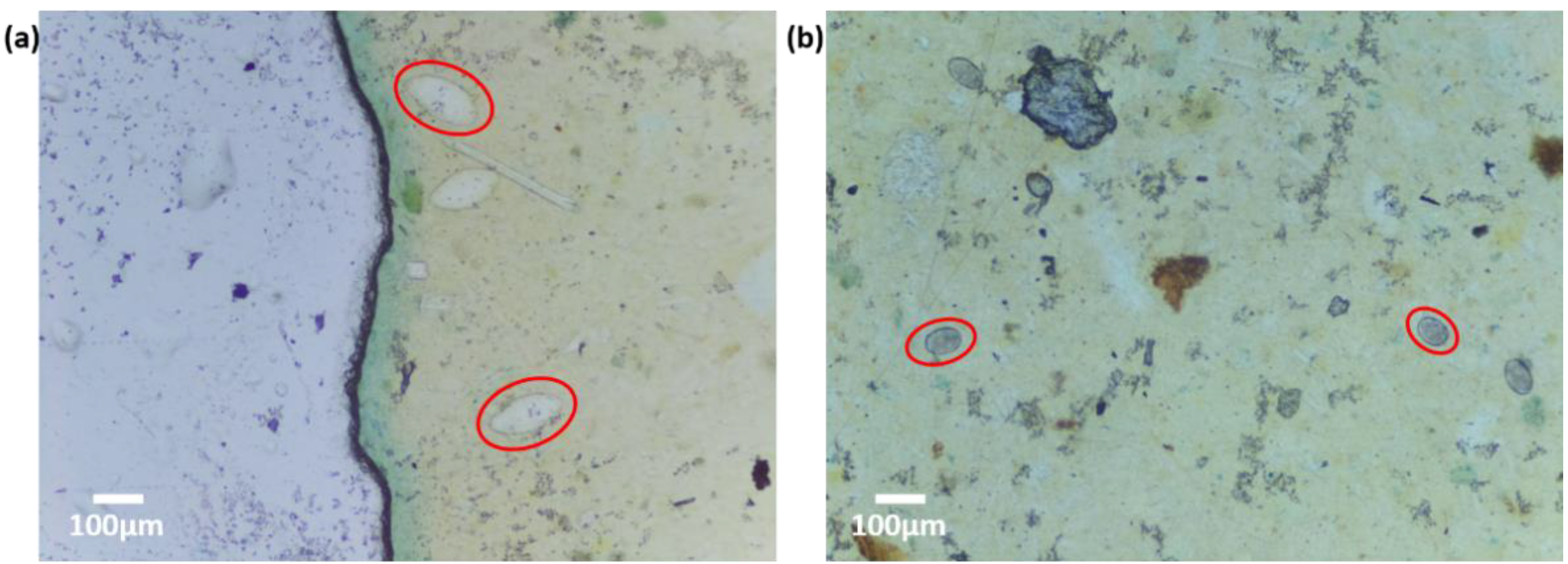 Micromachines 13 00643 g006