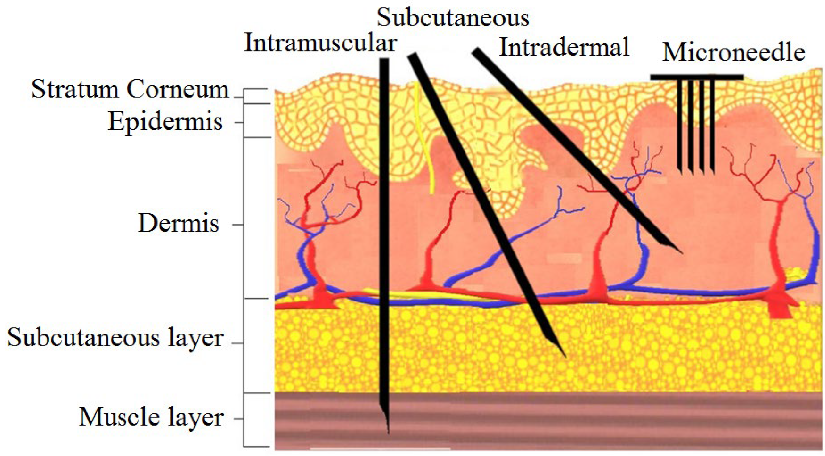 Micromachines 13 00657 g001