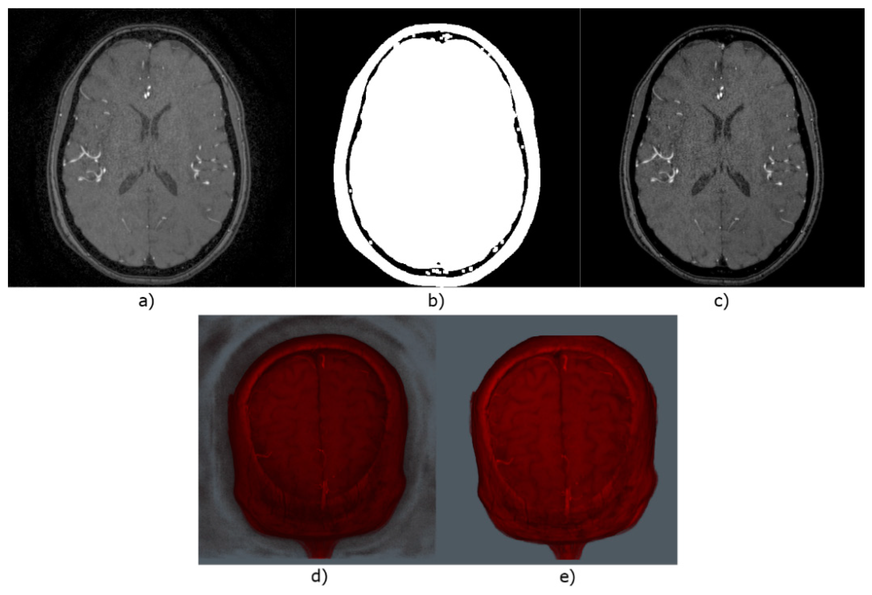 Micromachines 13 00823 g002