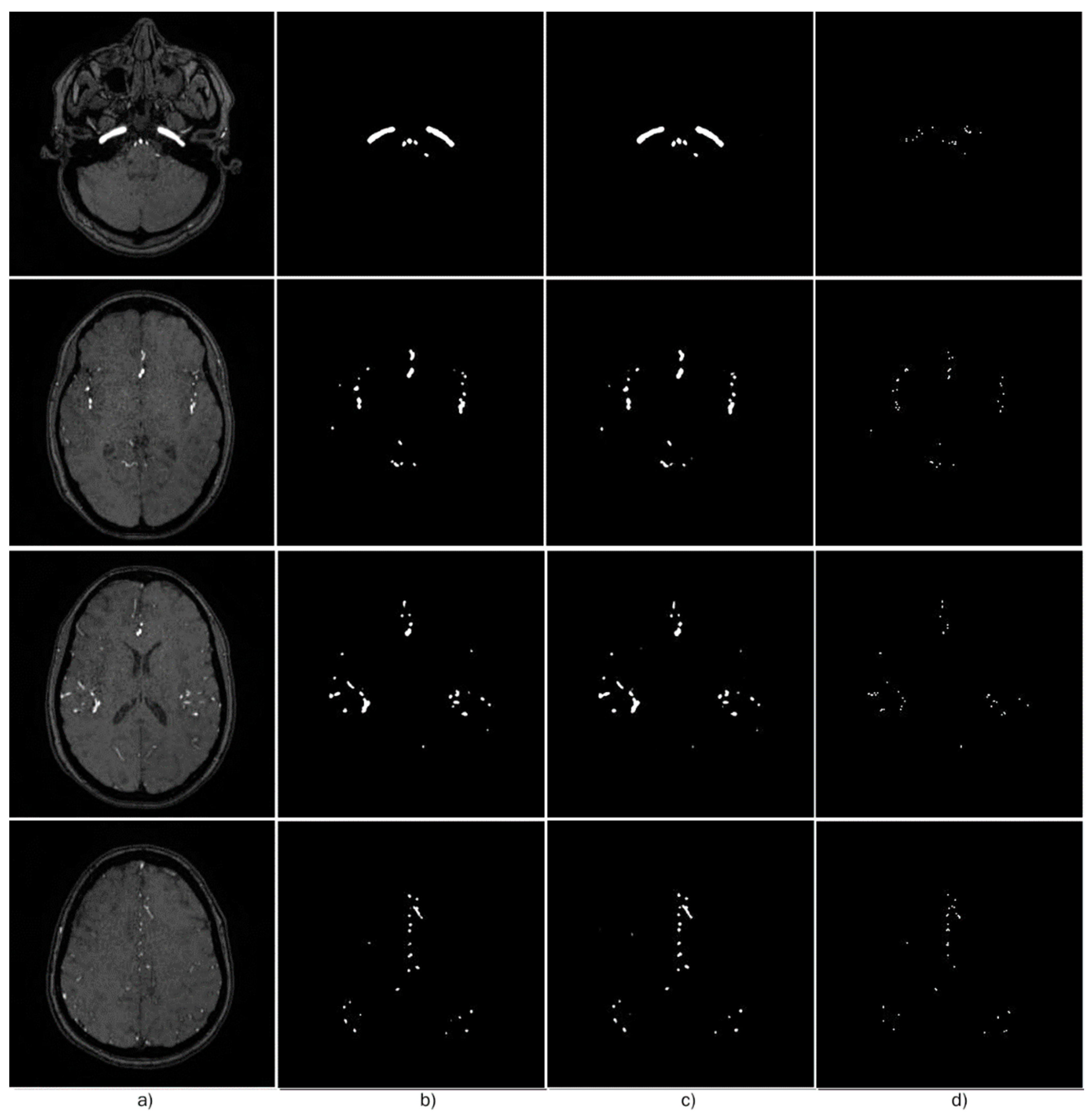 Micromachines 13 00823 g006