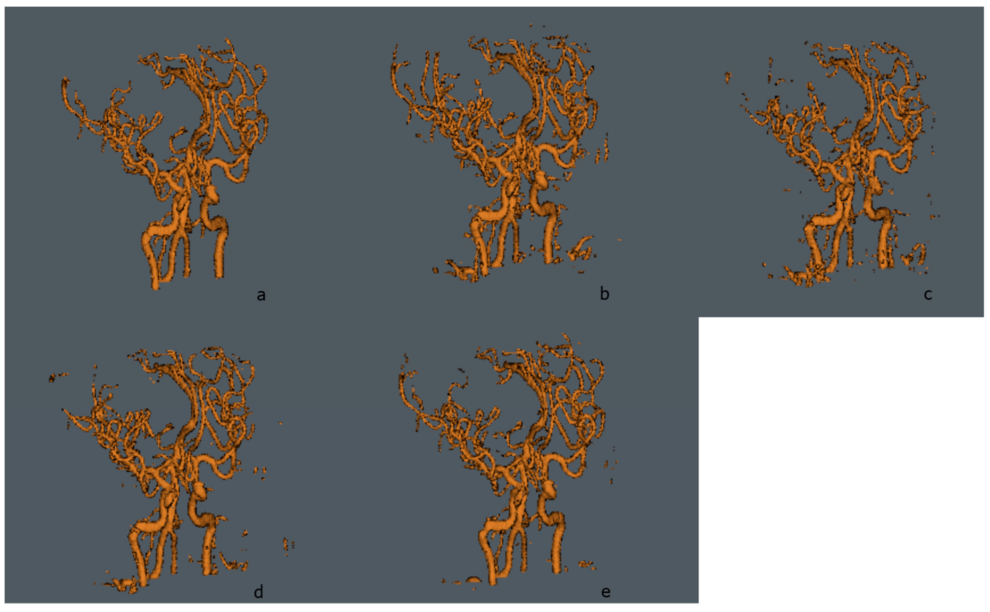 Micromachines 13 00823 g007