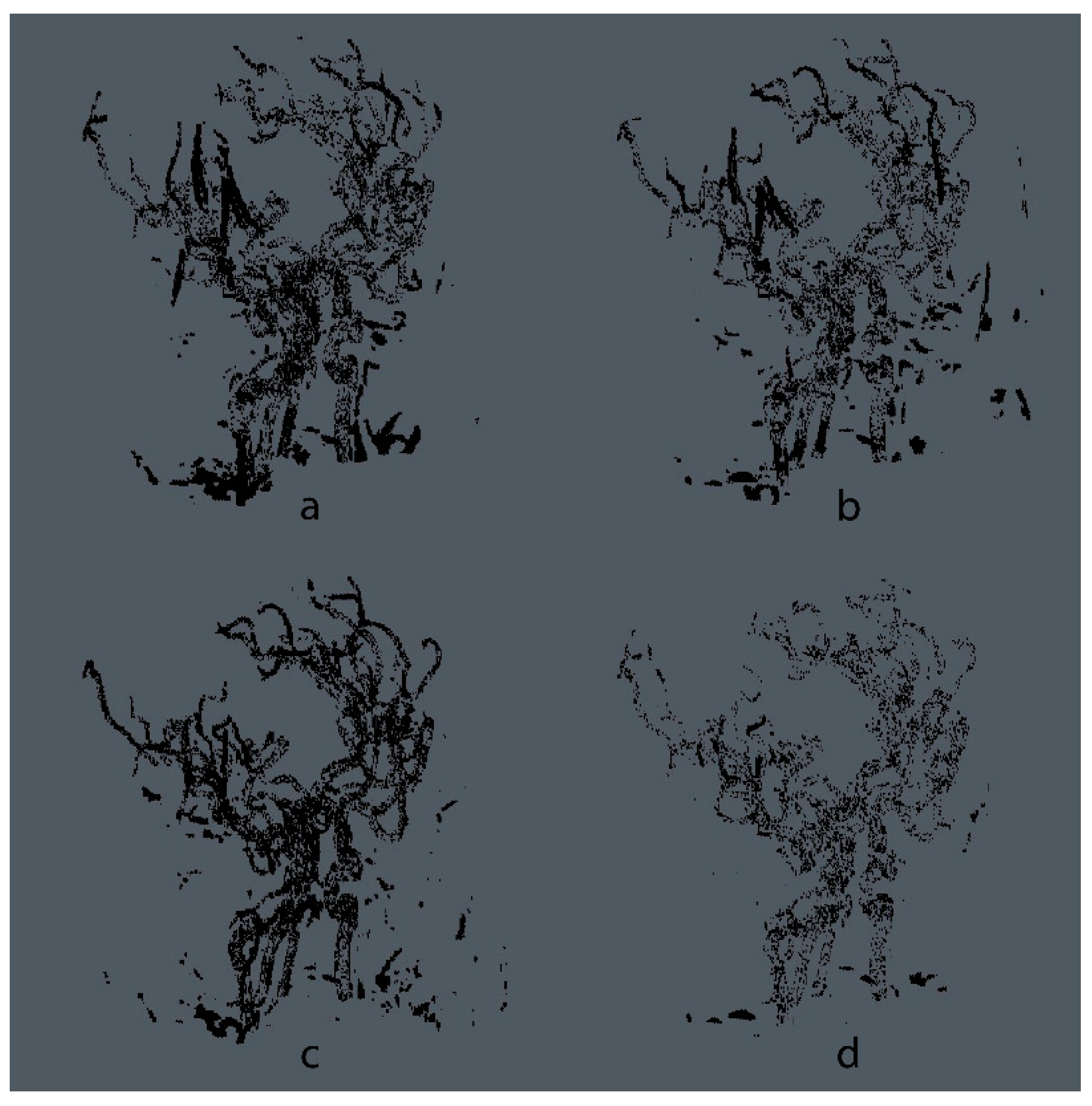 Micromachines 13 00823 g008