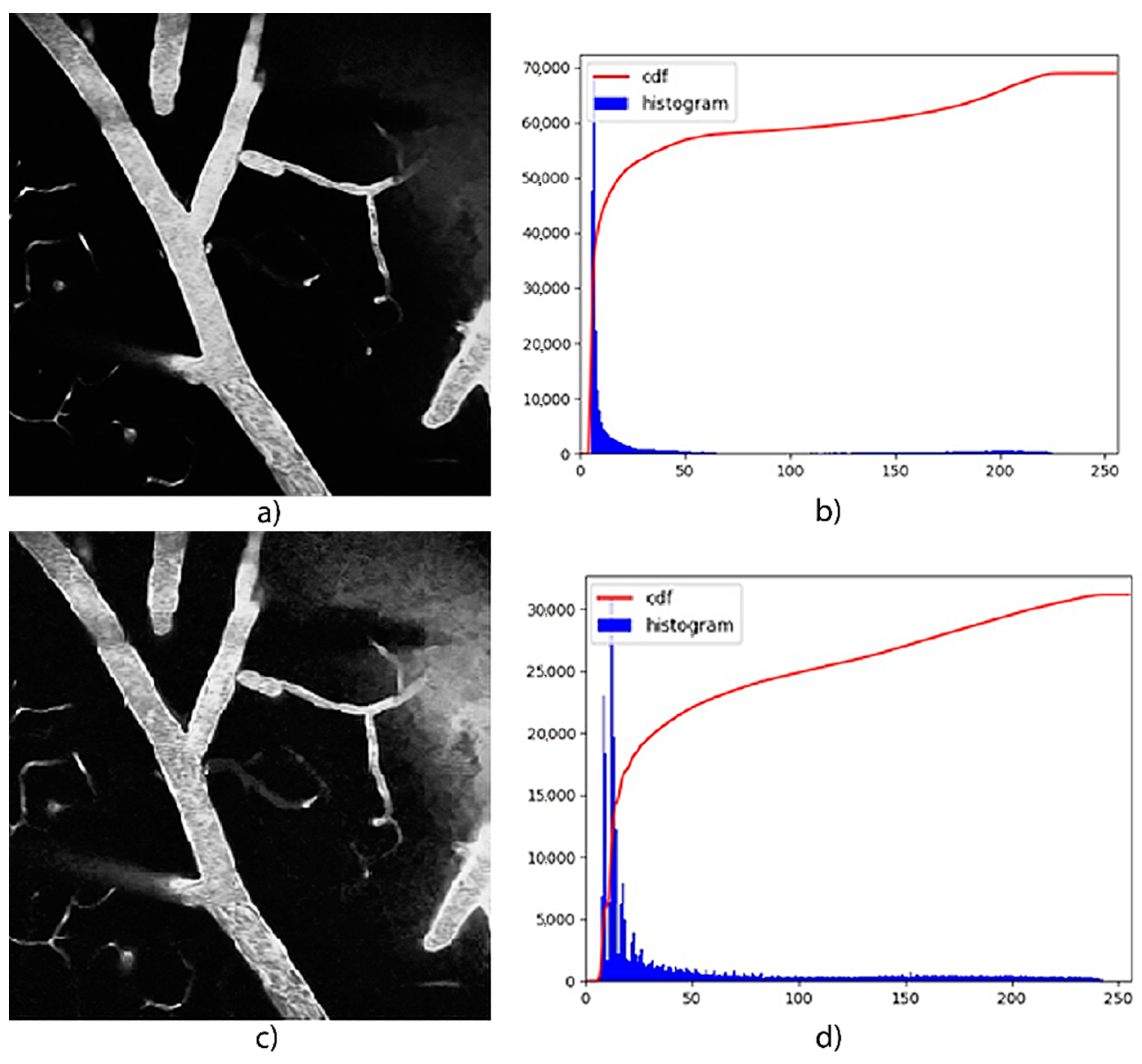 Micromachines 13 00823 g009