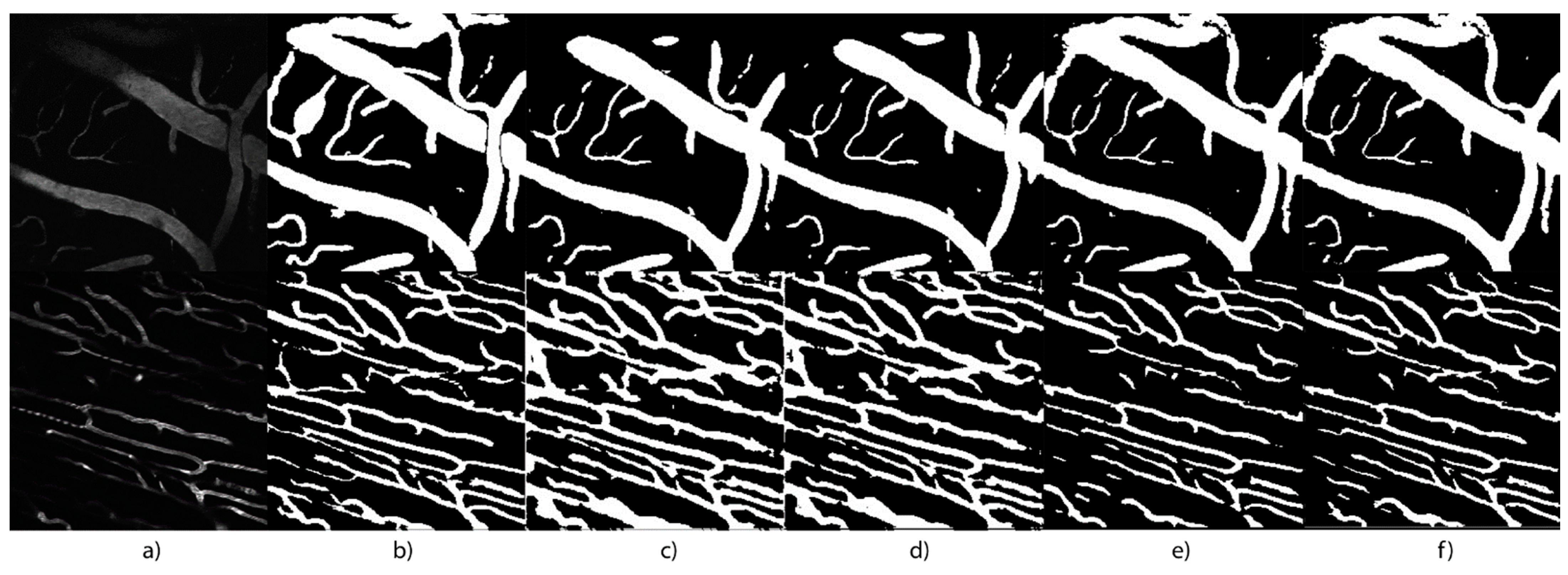Micromachines 13 00823 g010