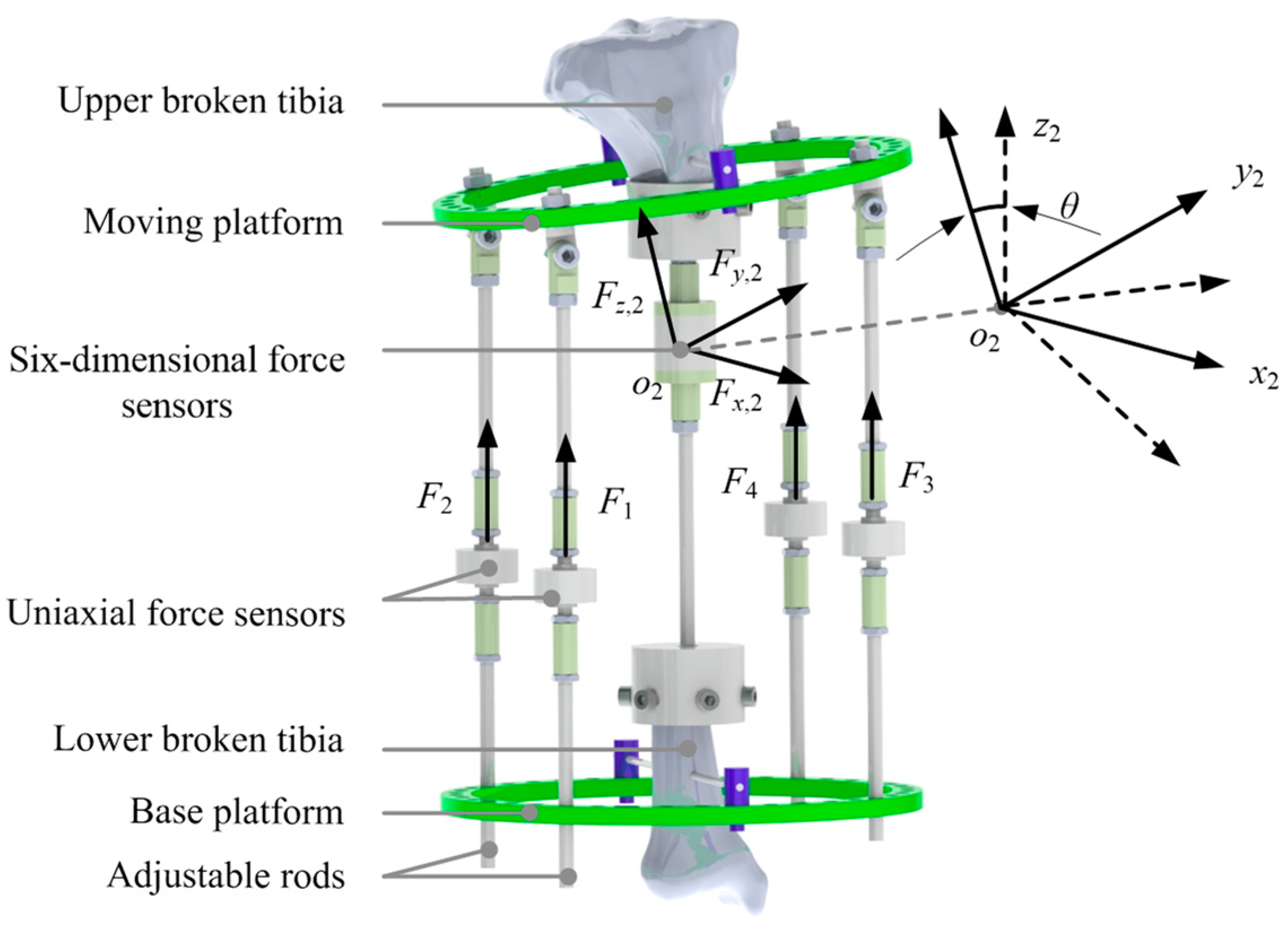 Micromachines 13 00932 g004