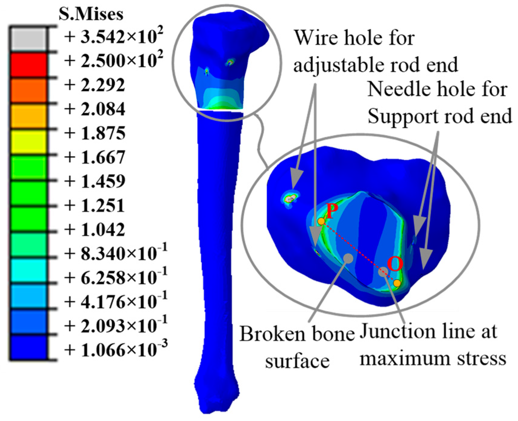 Micromachines 13 00932 g010
