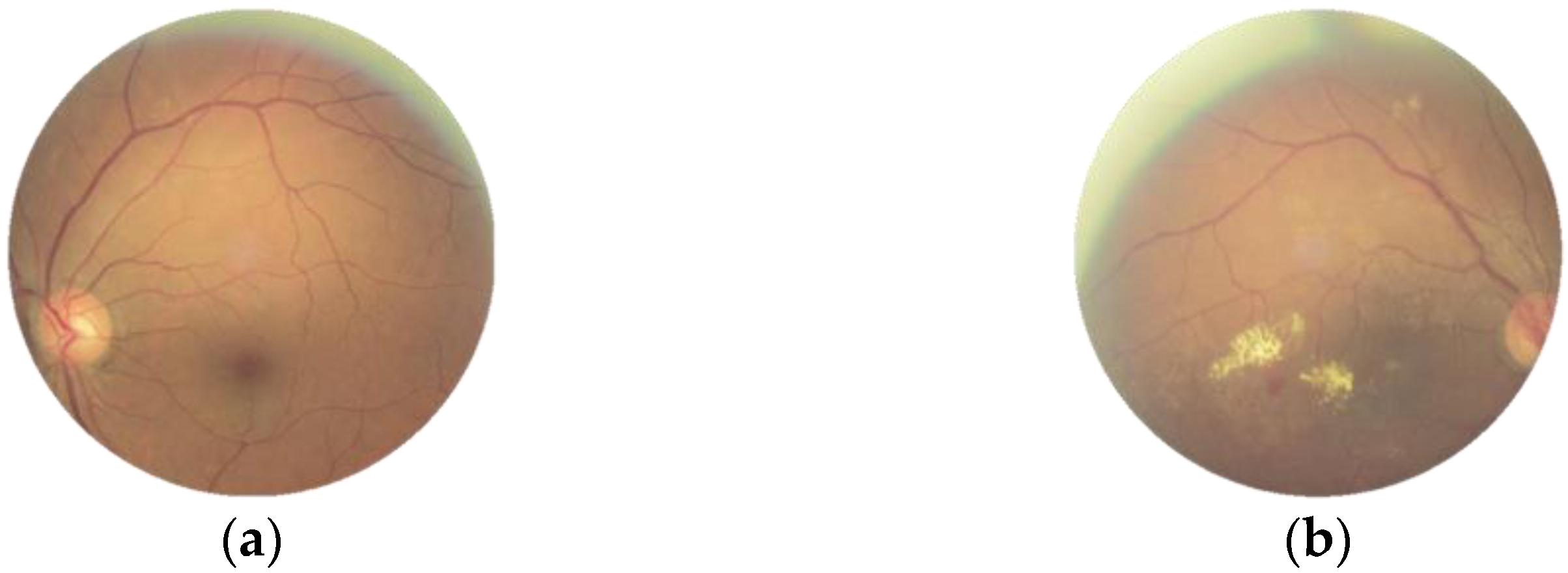 Micromachines 13 00947 g001