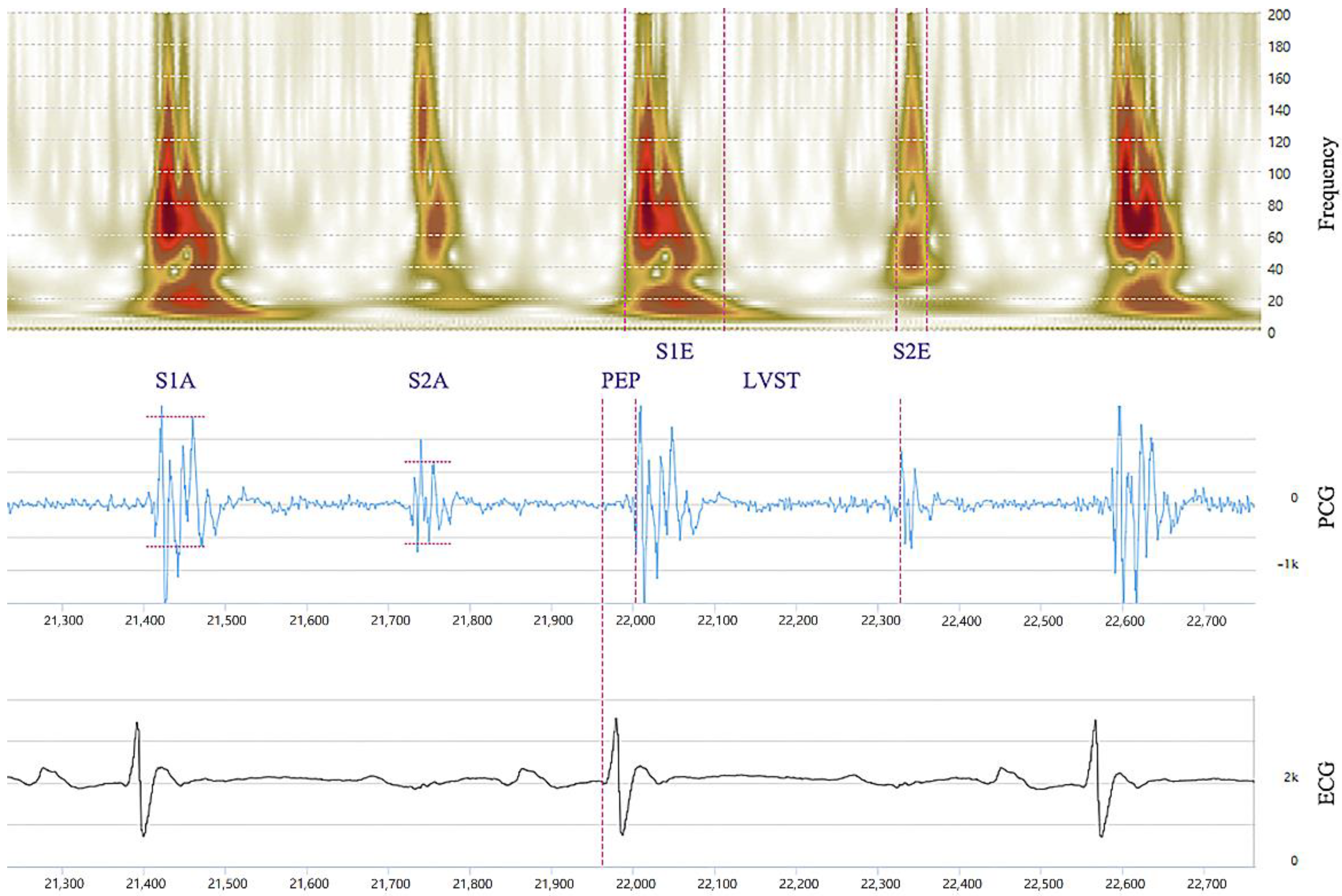 Micromachines 13 01027 g003
