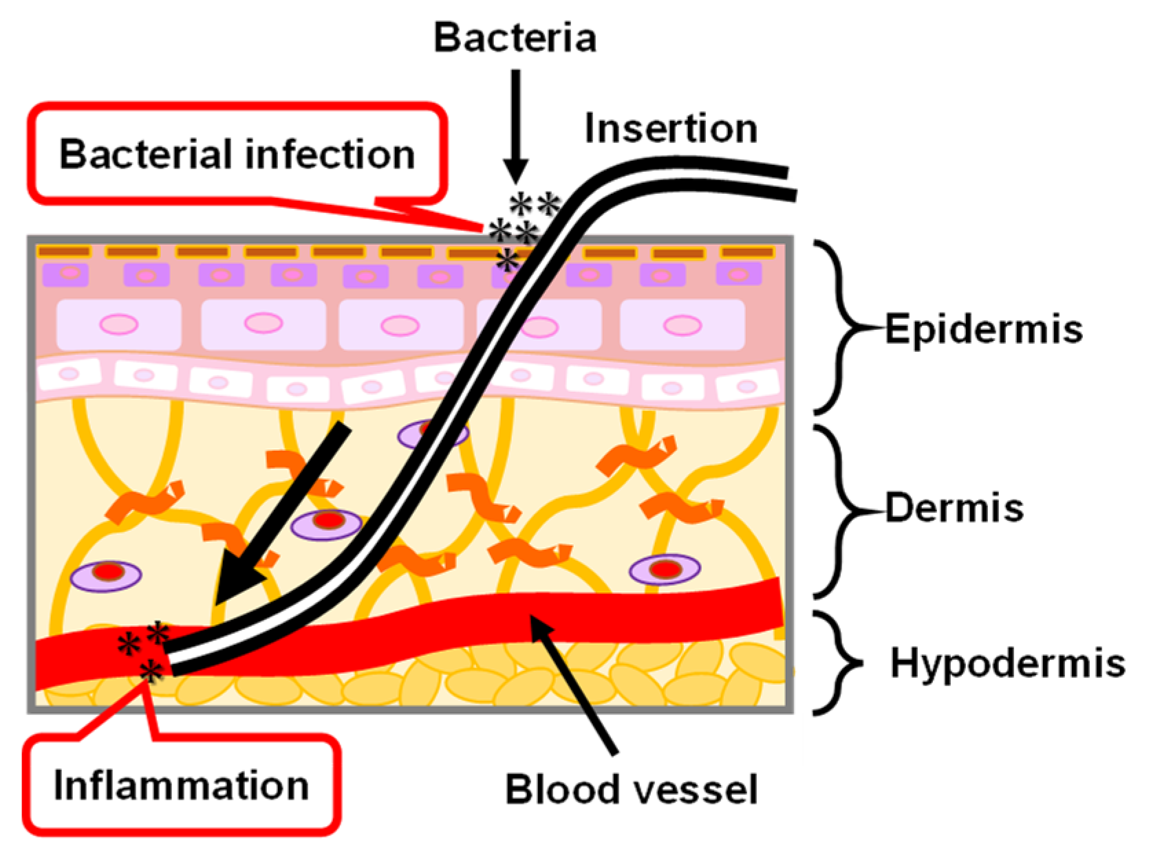 Micromachines 13 01358 g012