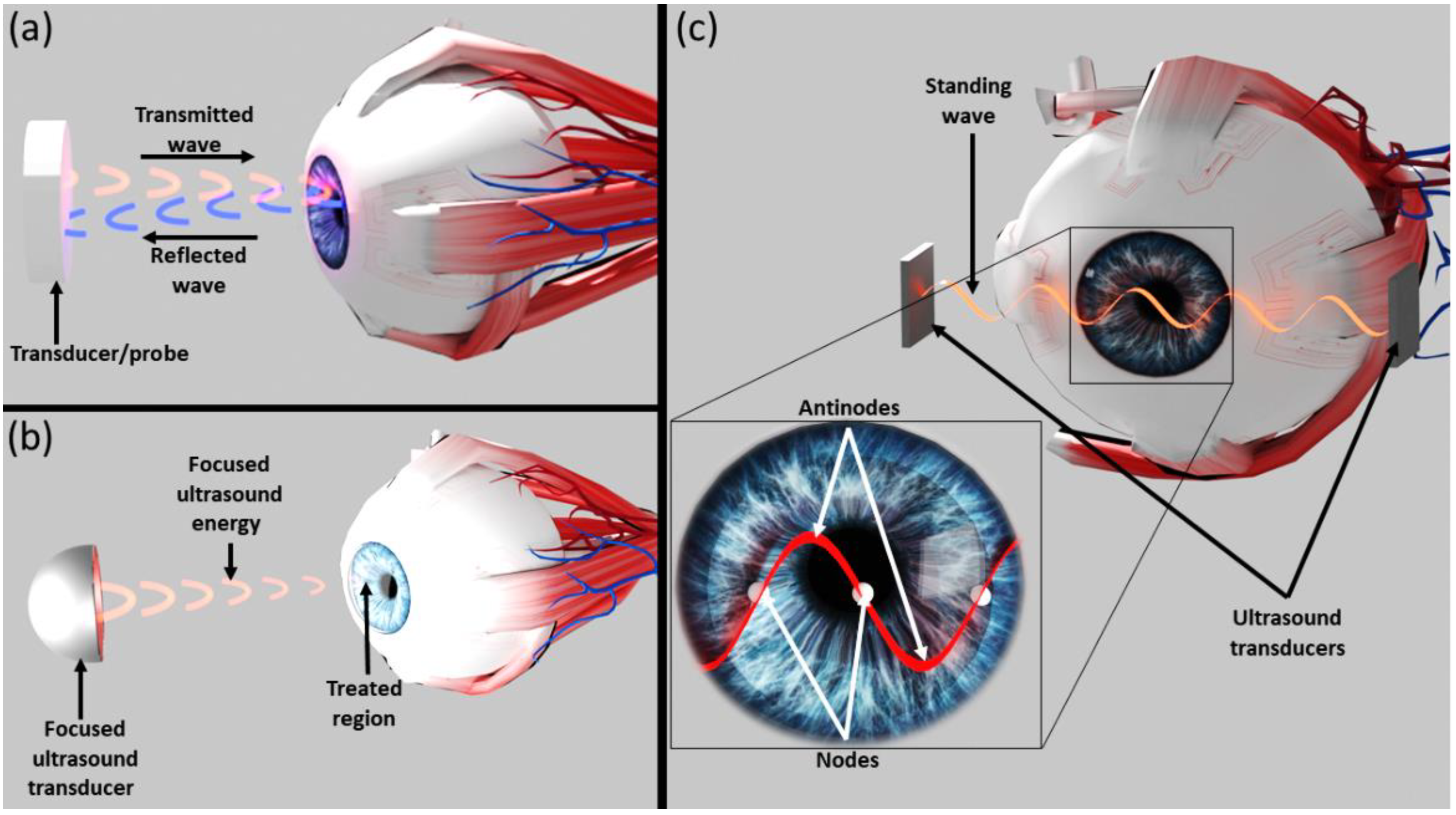 Micromachines 13 01362 g001