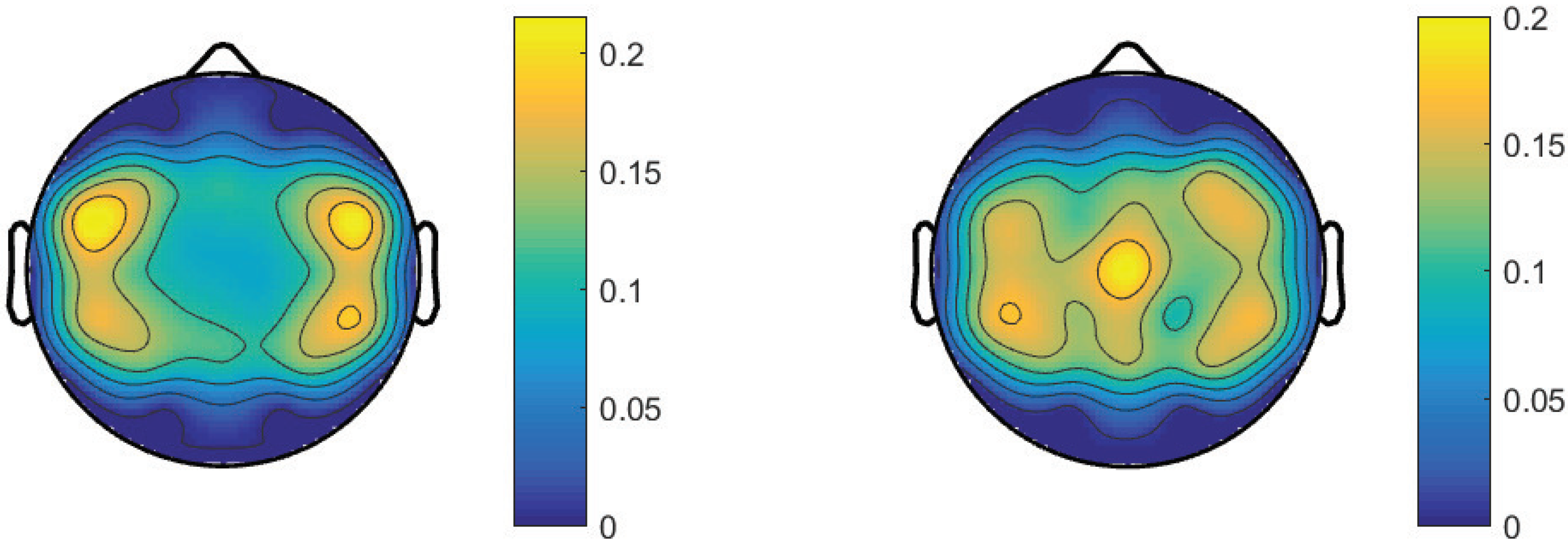 Micromachines 13 01485 g008