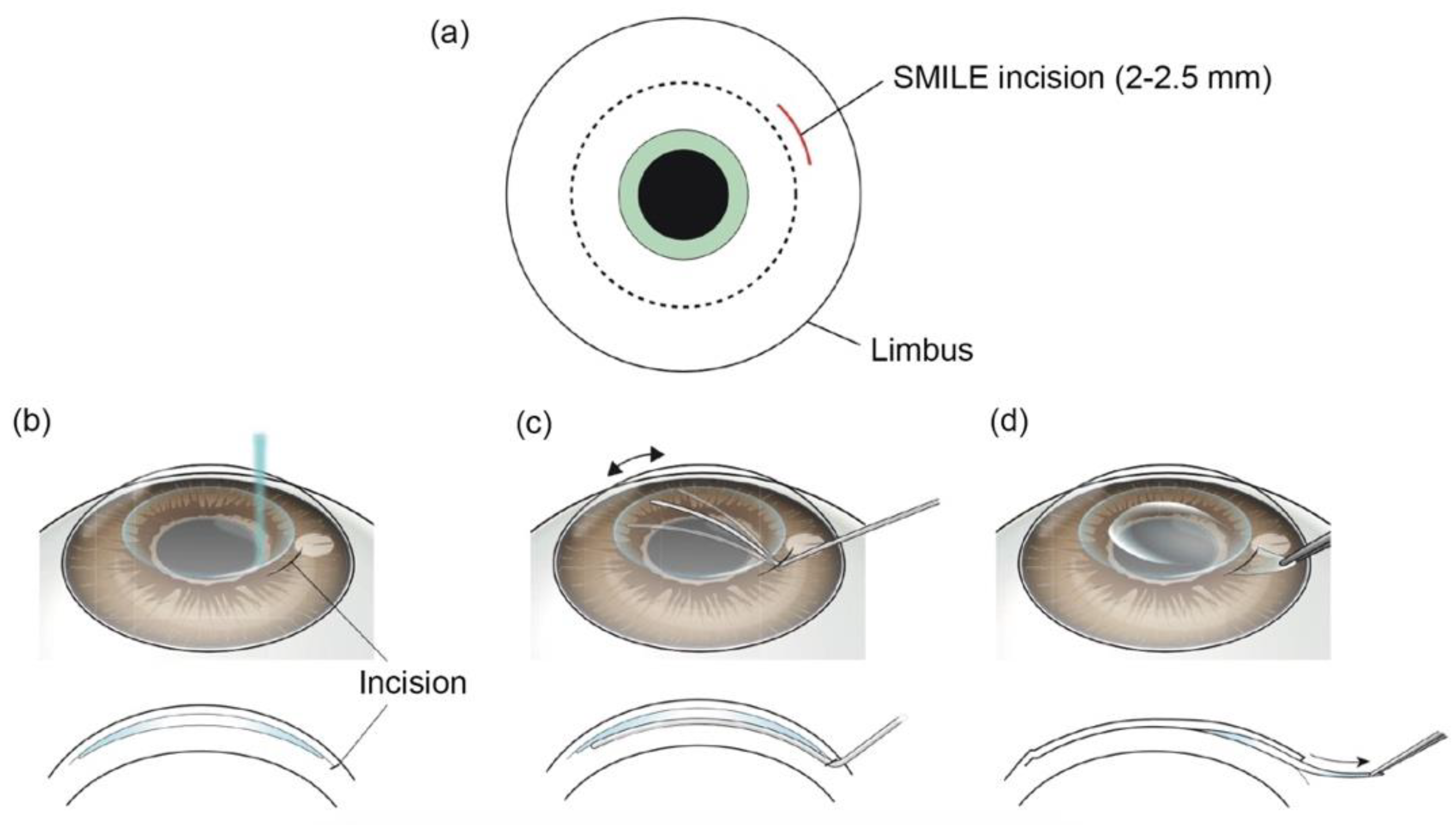 Micromachines 13 01653 g004