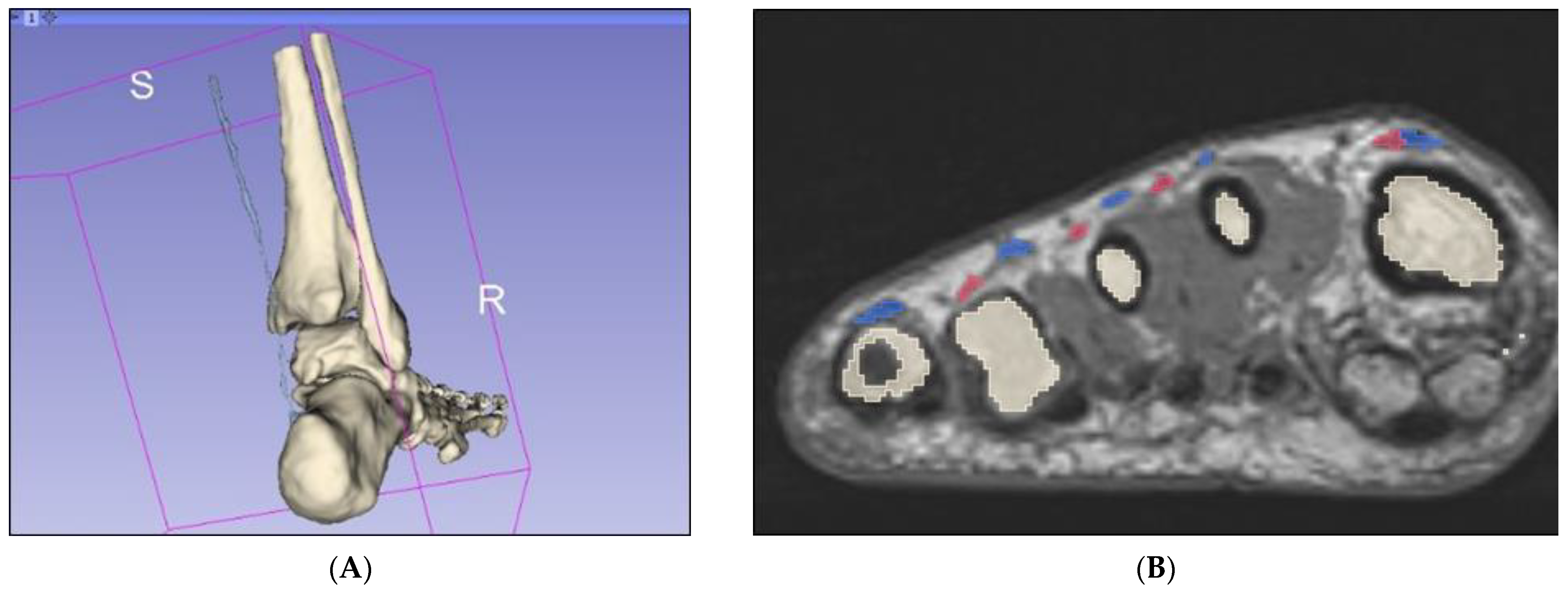 Micromachines 13 01701 g006