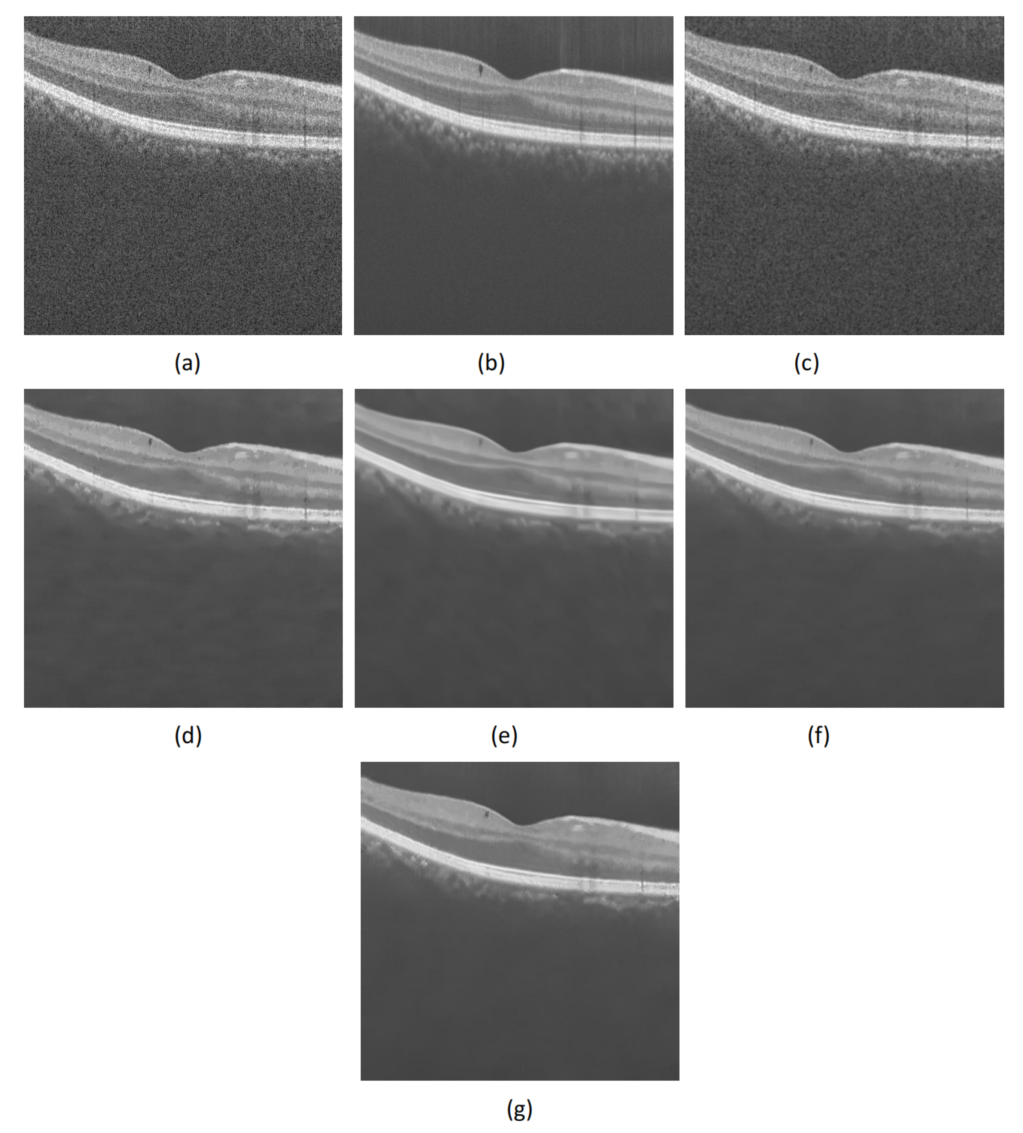Micromachines 13 02039 g003