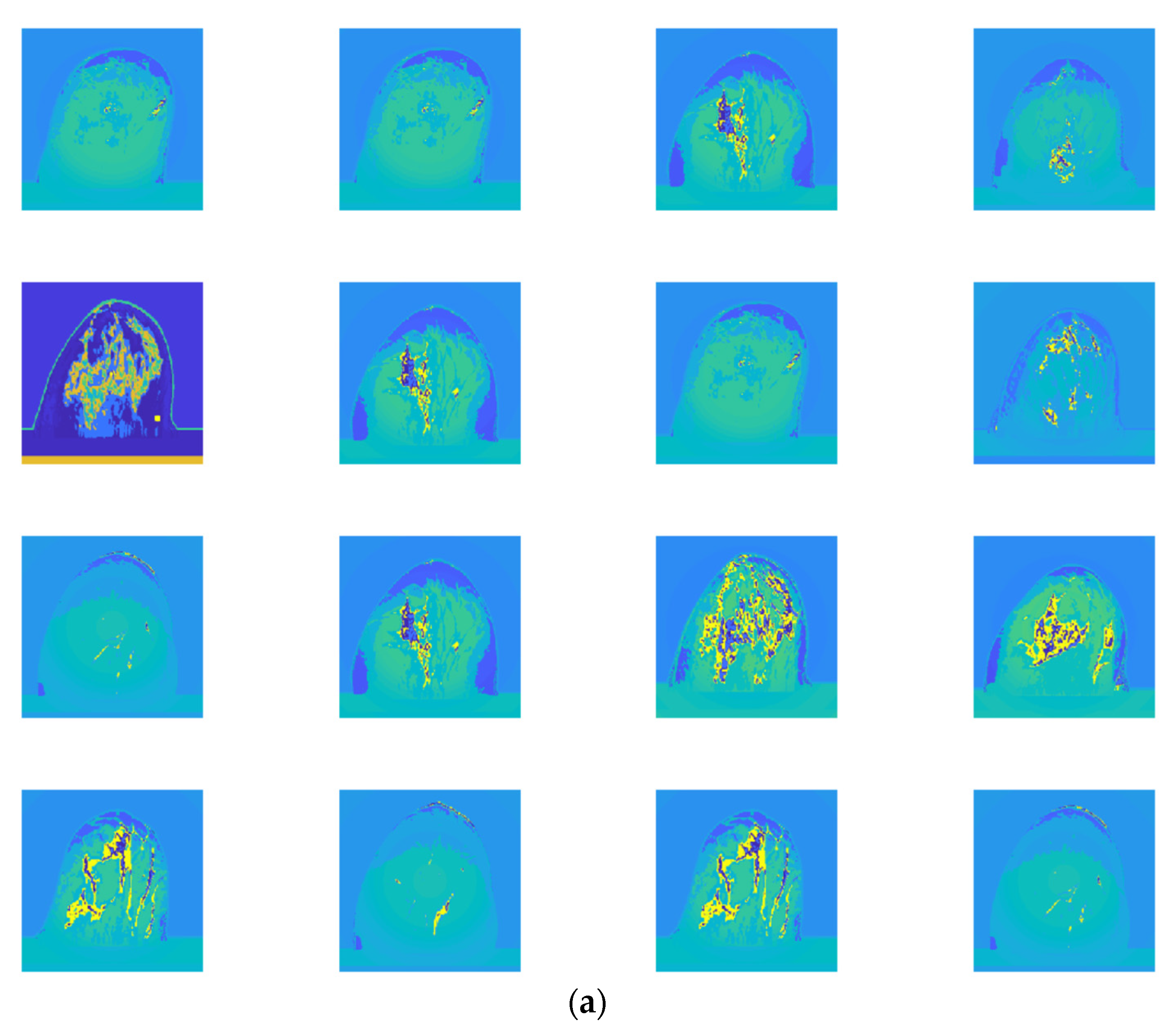 Micromachines 13 02049 g005a