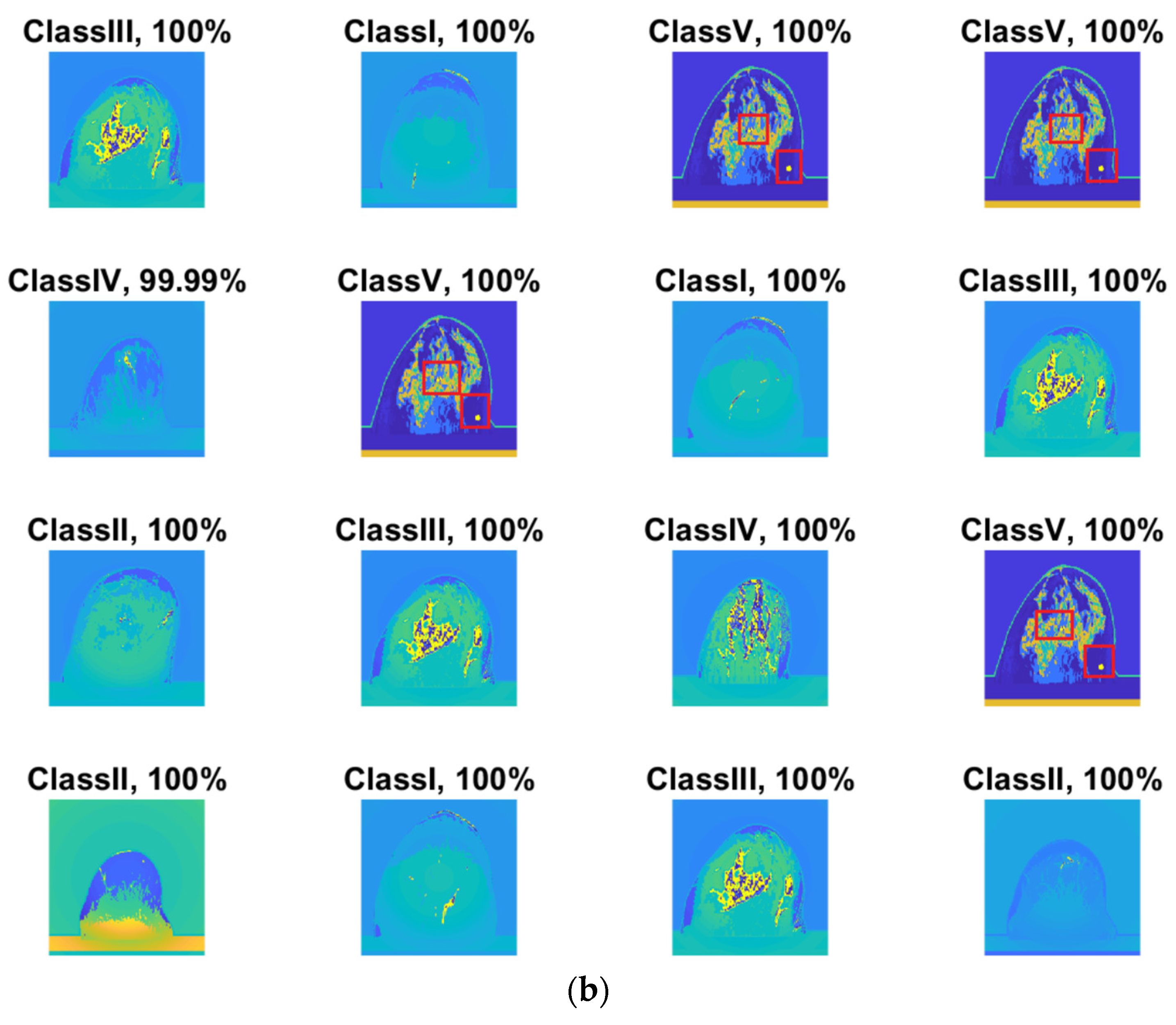Micromachines 13 02049 g005b