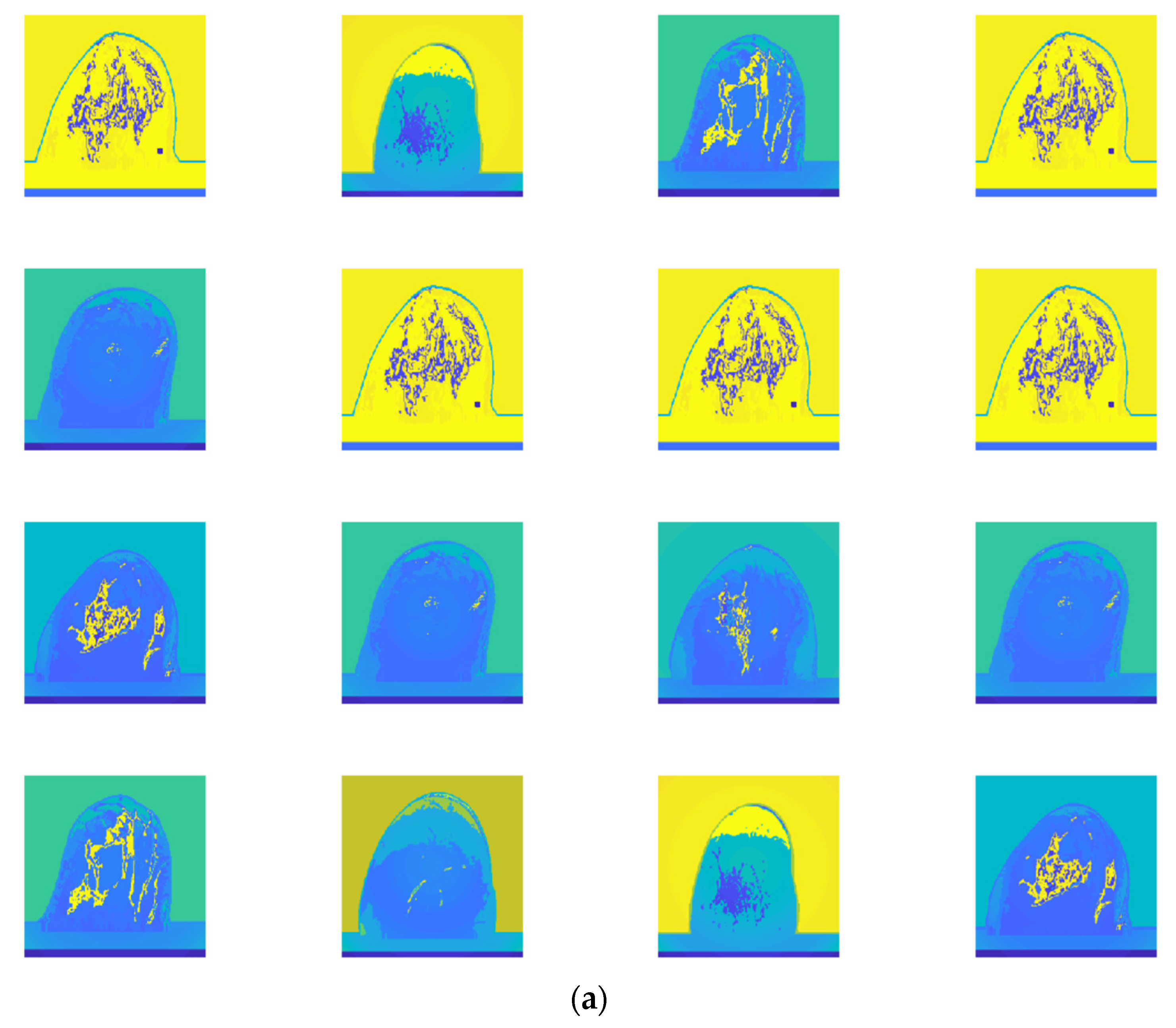 Micromachines 13 02049 g006a