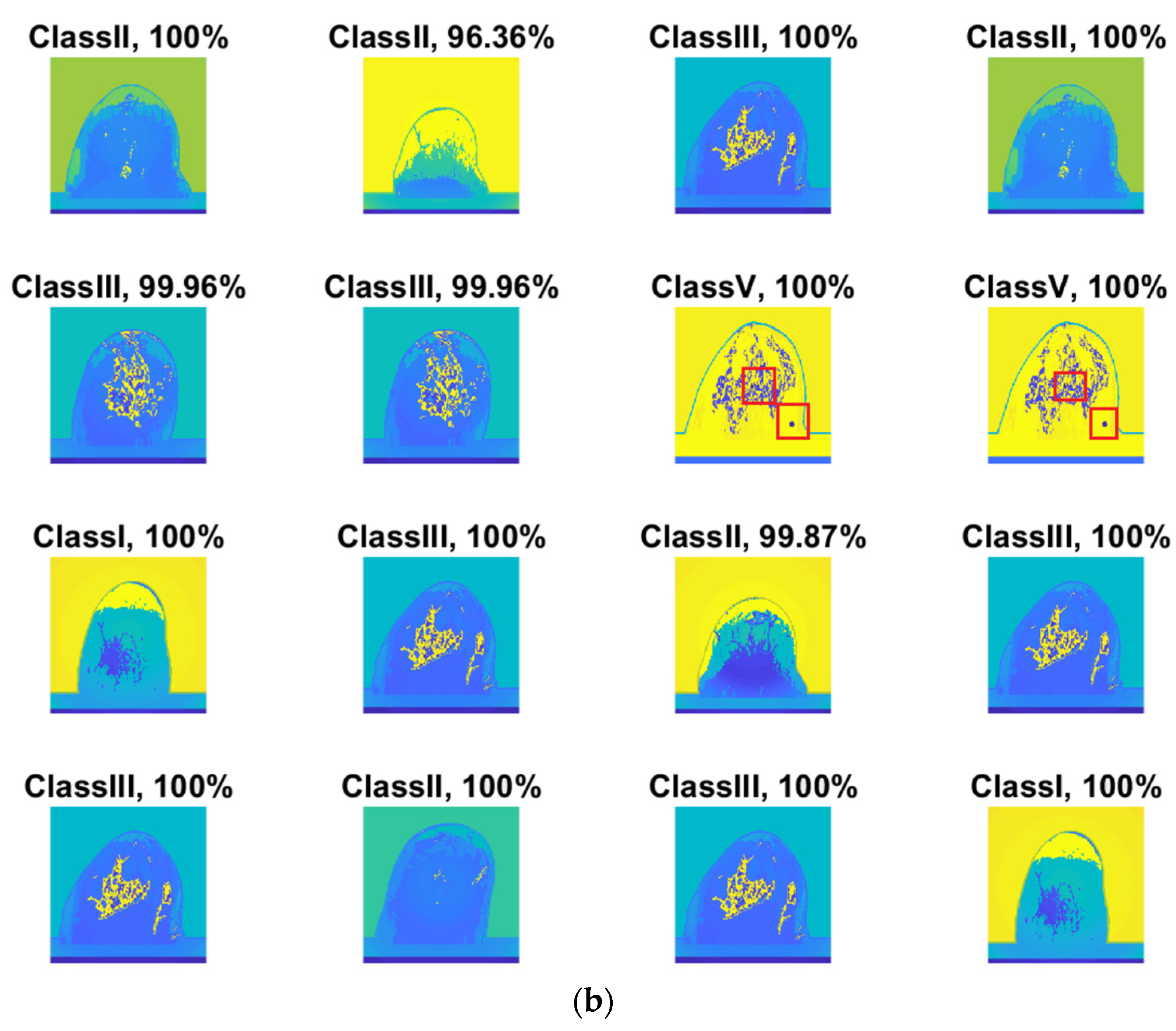 Micromachines 13 02049 g006b