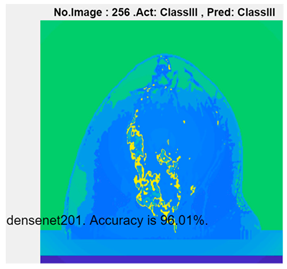 Micromachines 13 02049 i003