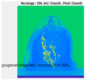 Micromachines 13 02049 i007